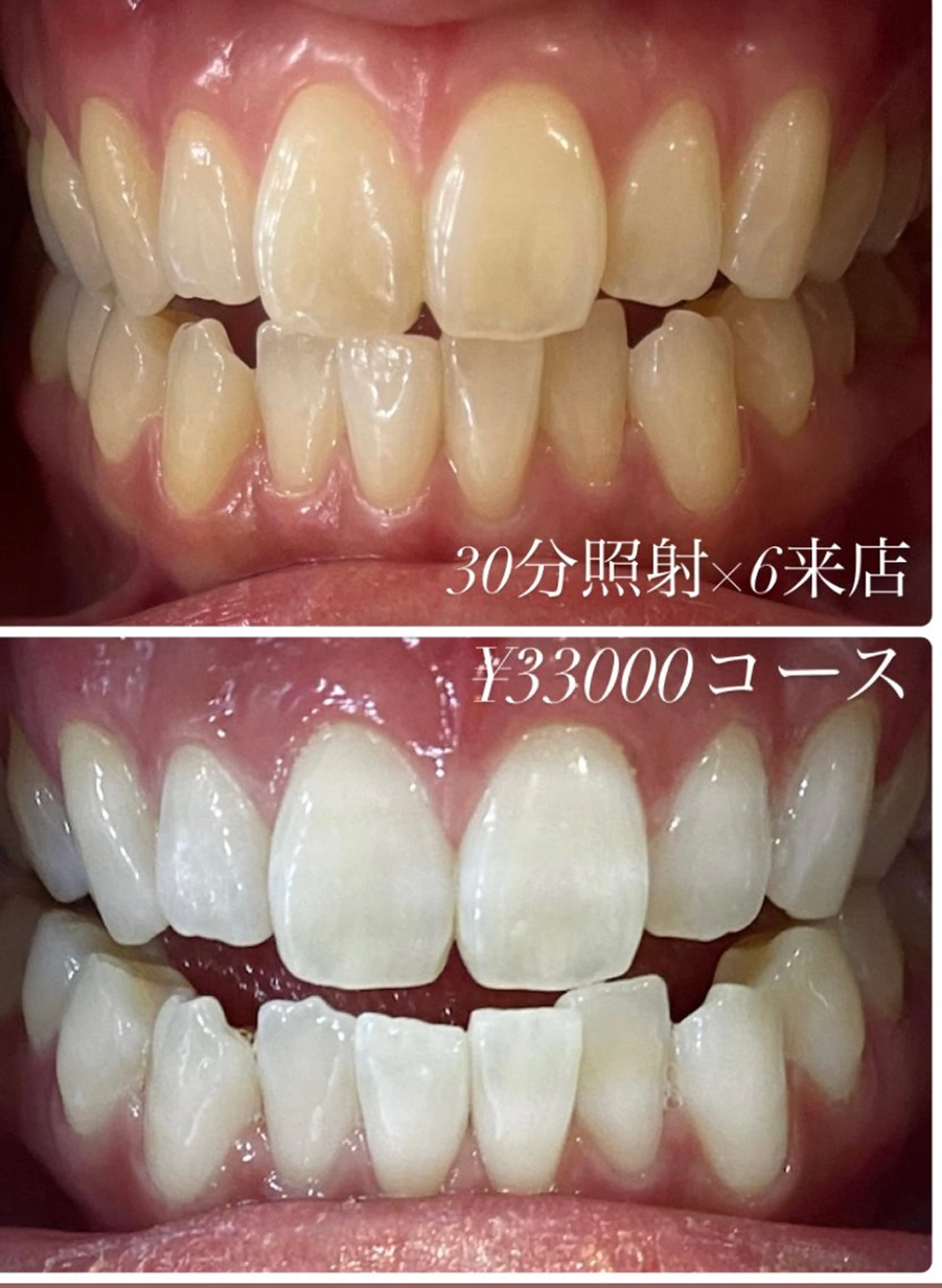 その他 ホワイトニング ルーム　川崎店のその他イメージ