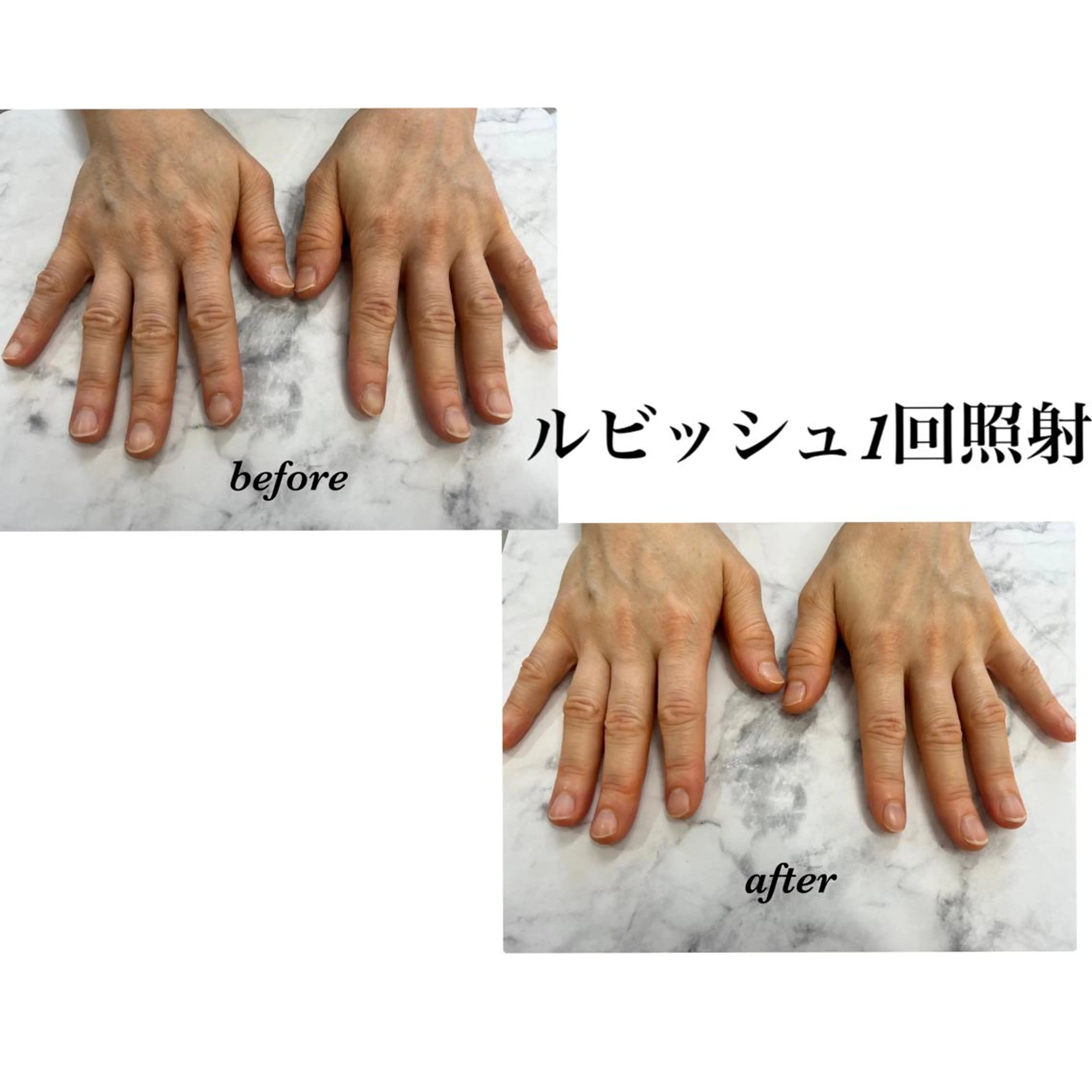 ネイル Regene ARAKIのネイルデザイン