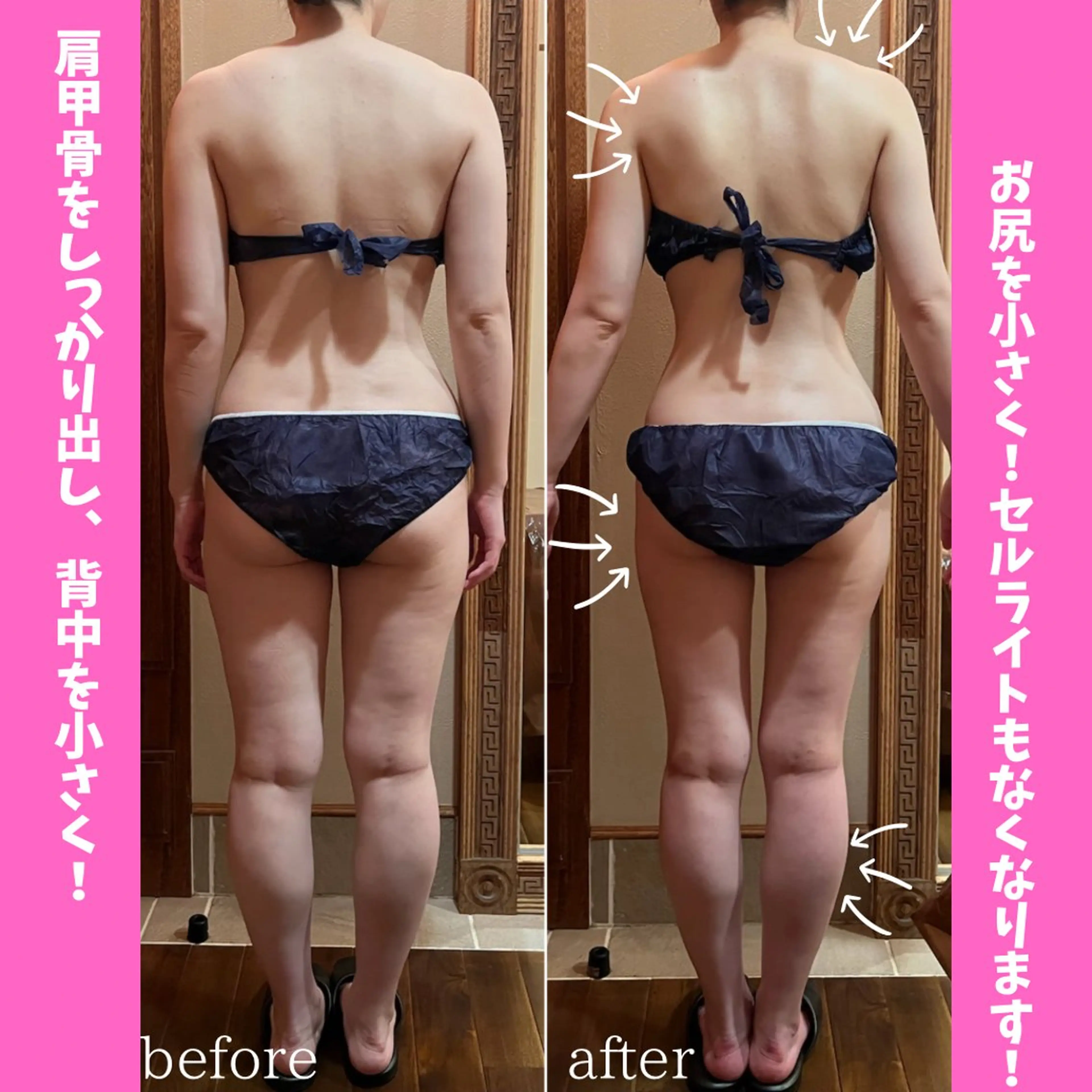 エステ リラク 痩身&美肌サロン 堀米✨のその他イメージ