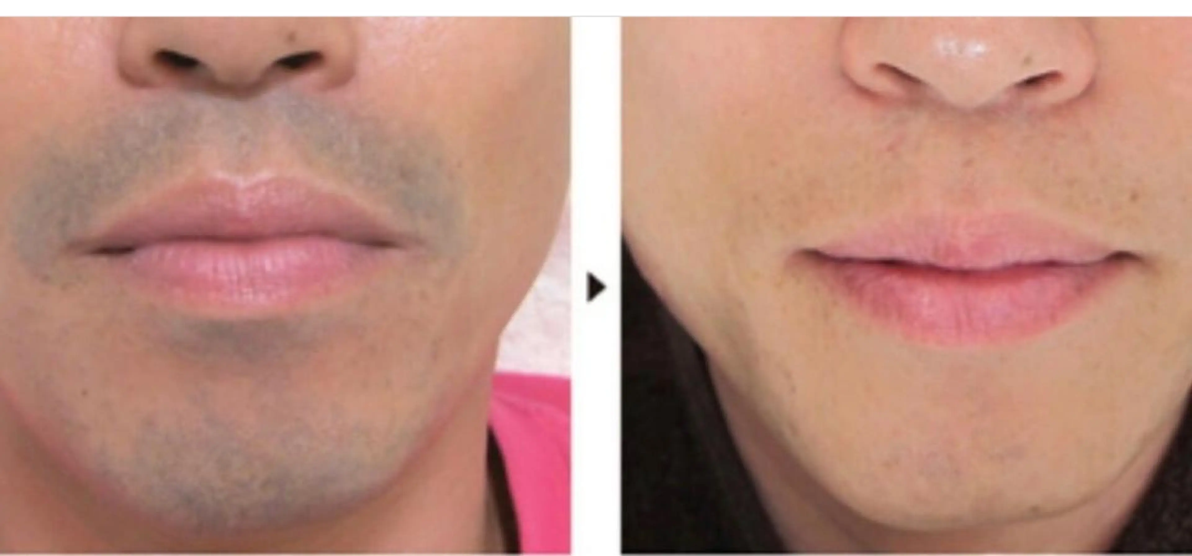 メンズ プライベートサロン BRAG🏠男女OKのエステ・リラクイメージ