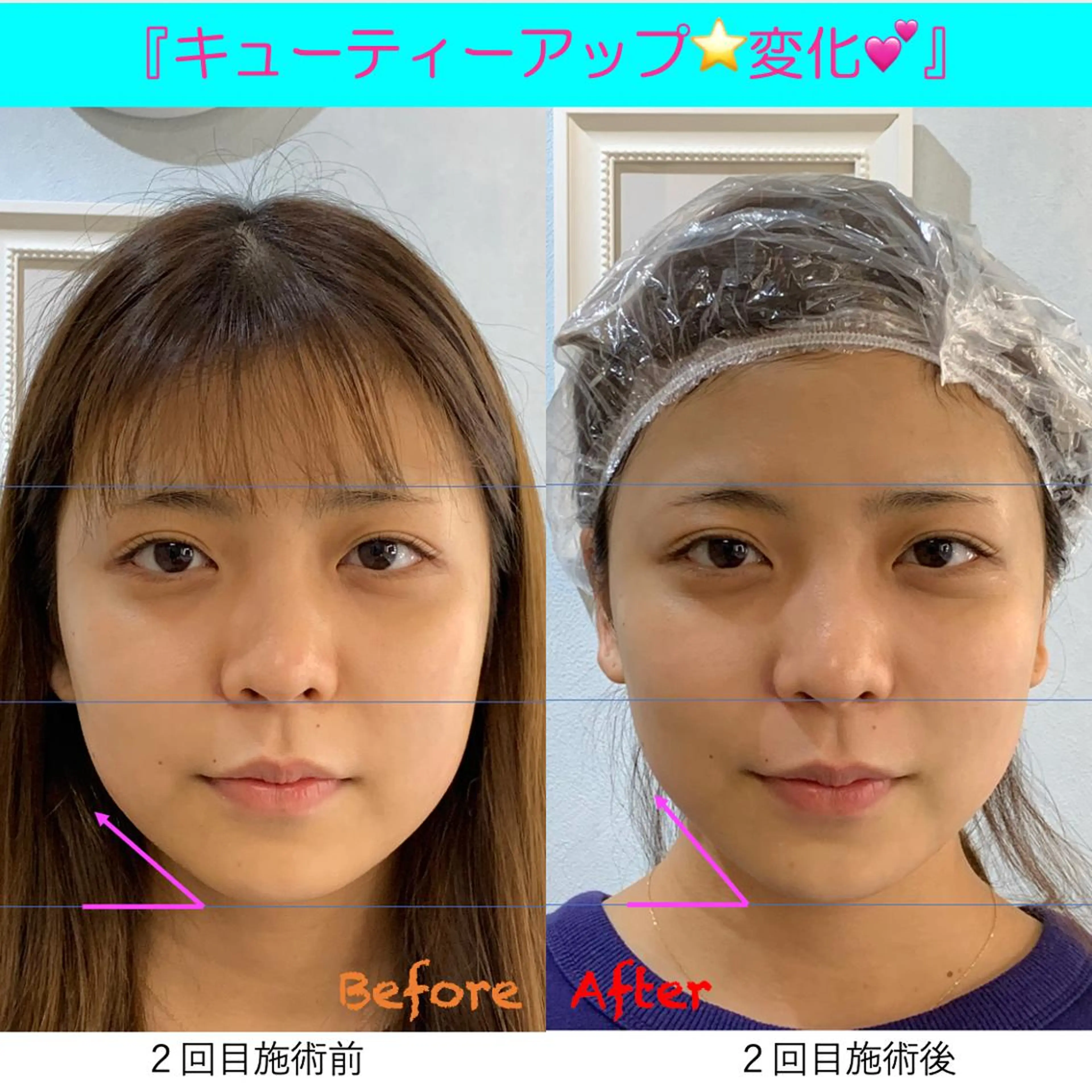 小顔美肌&痩身ｻﾛﾝ My Timeのエステ・リラクイメージ