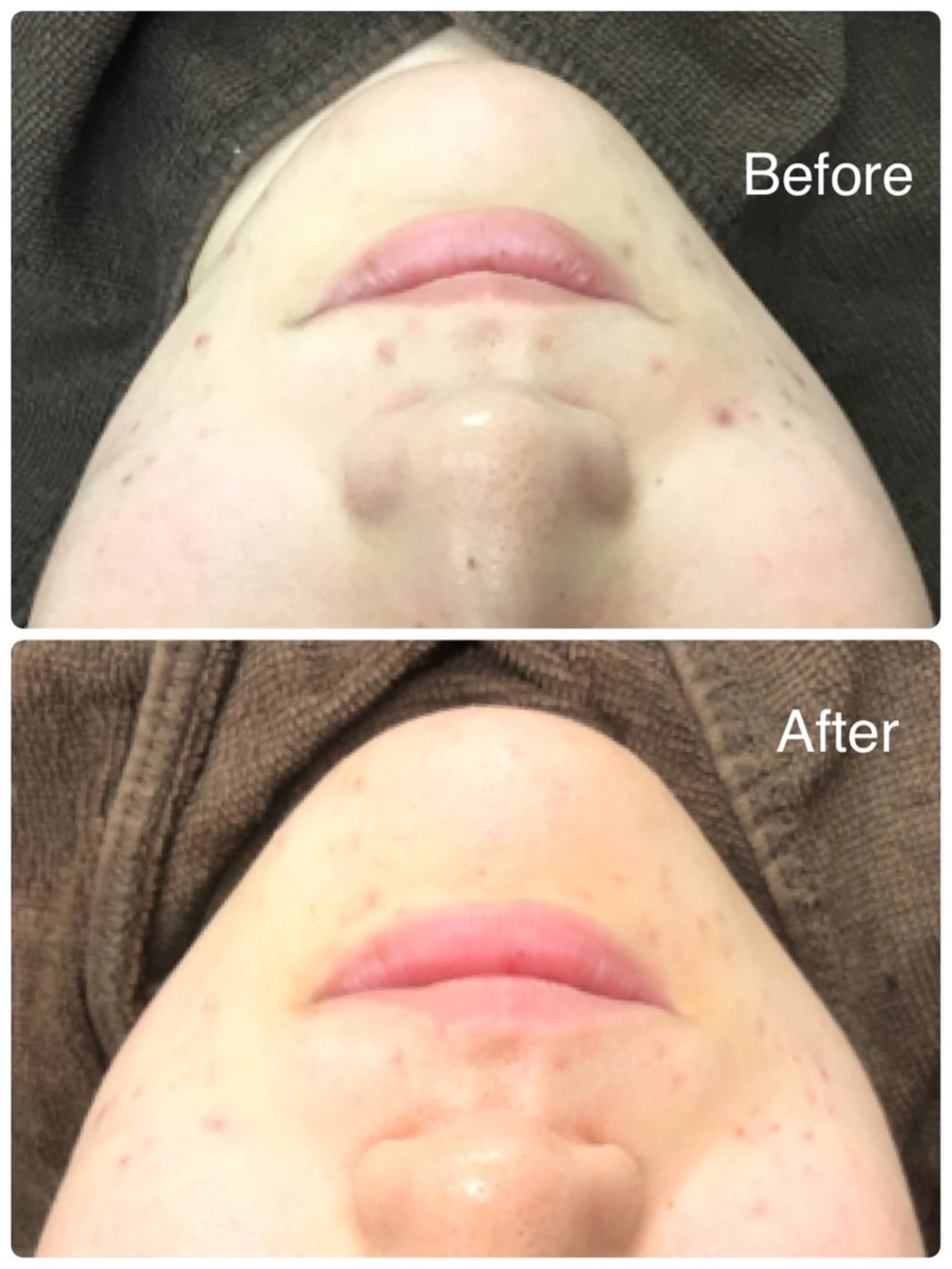 エステ 肌質改善サロン La Divinaのエステ・リラクイメージ