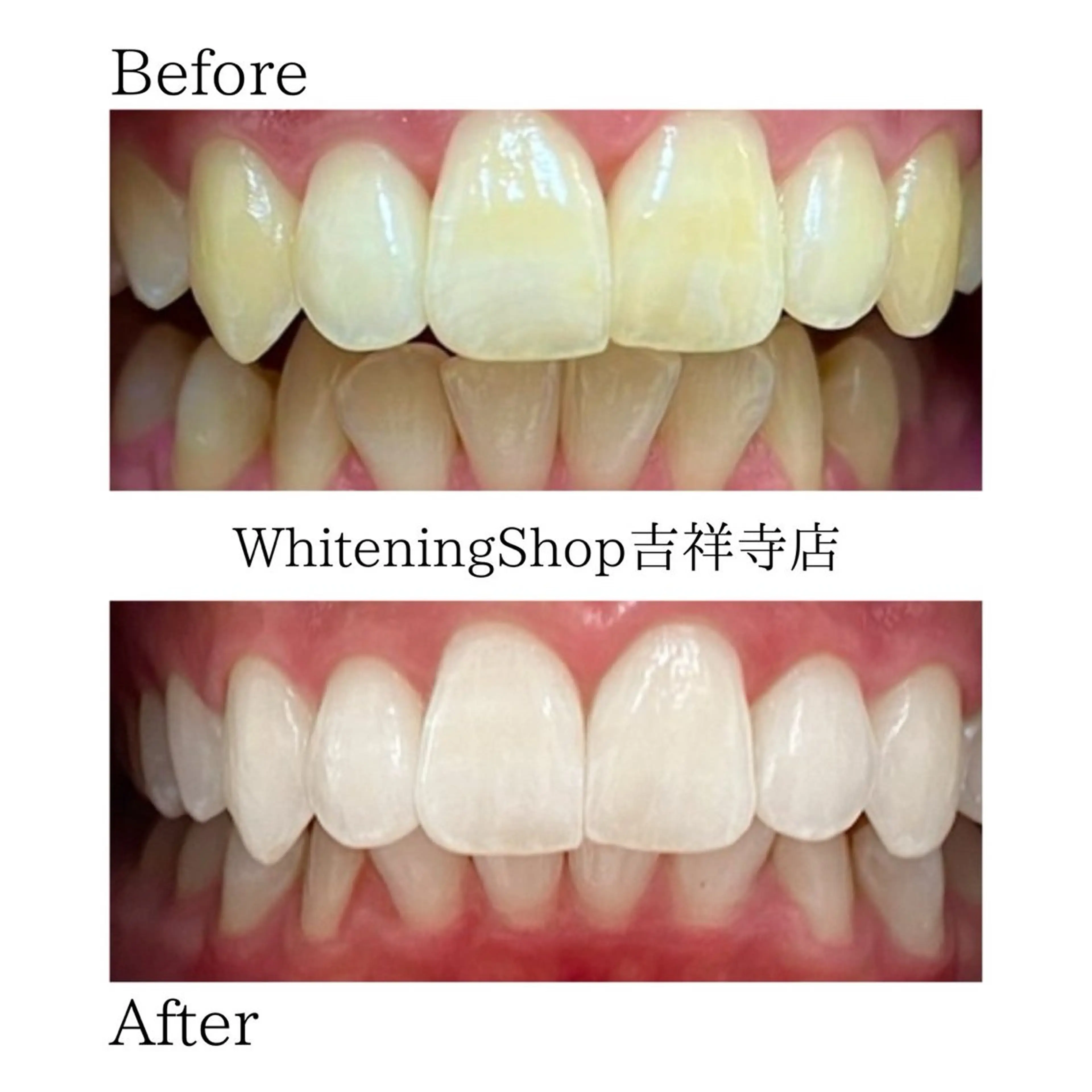 エステ リラク ホワイトニング ショップ吉祥寺店のエステ・リラクイメージ