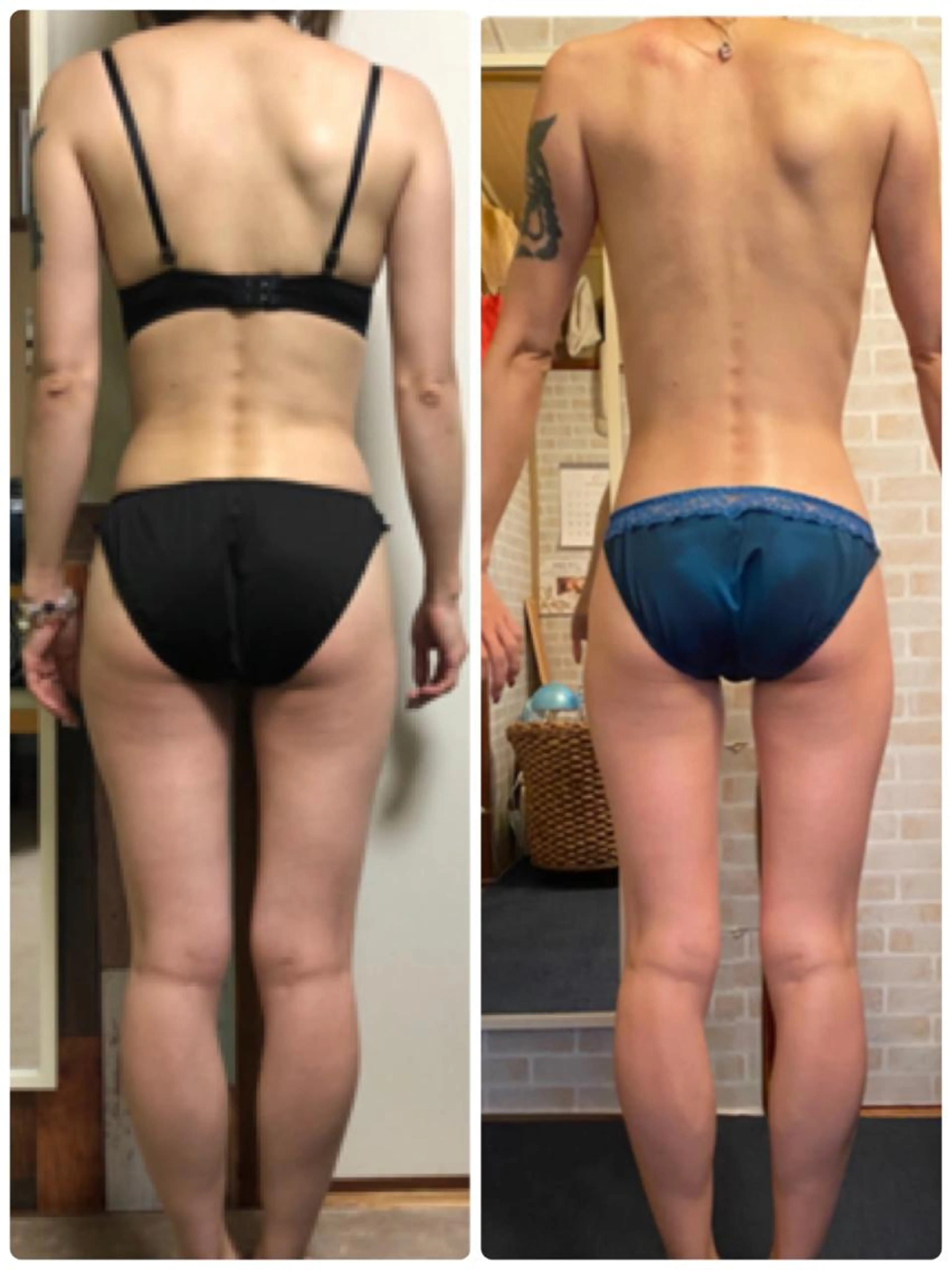 ミニモ初回期間限定🙌🏻💕   全身痩身エステ  ✴︎お腹  ✴︎背中  ✴︎ヒップ  ✴︎脚の写真