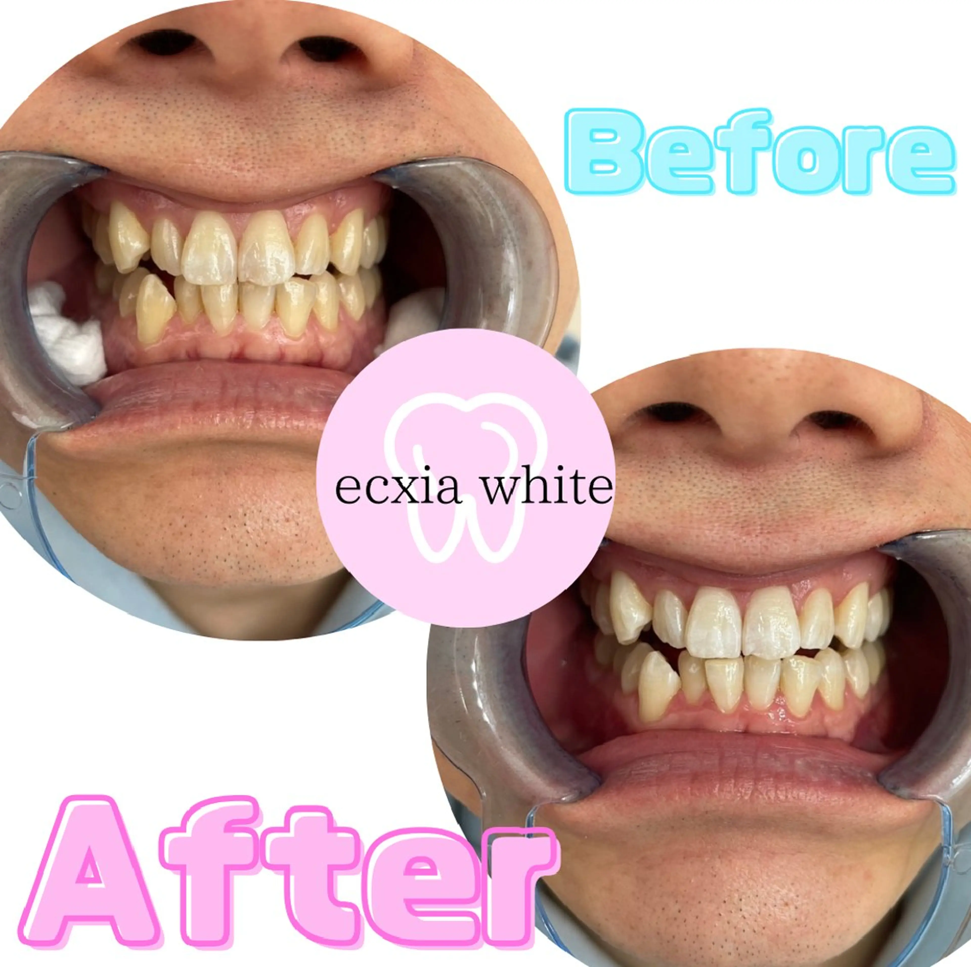 ecxia  white 　広島袋町店所属・セルフホワイトニング エクシア広島袋町店のその他イメージ