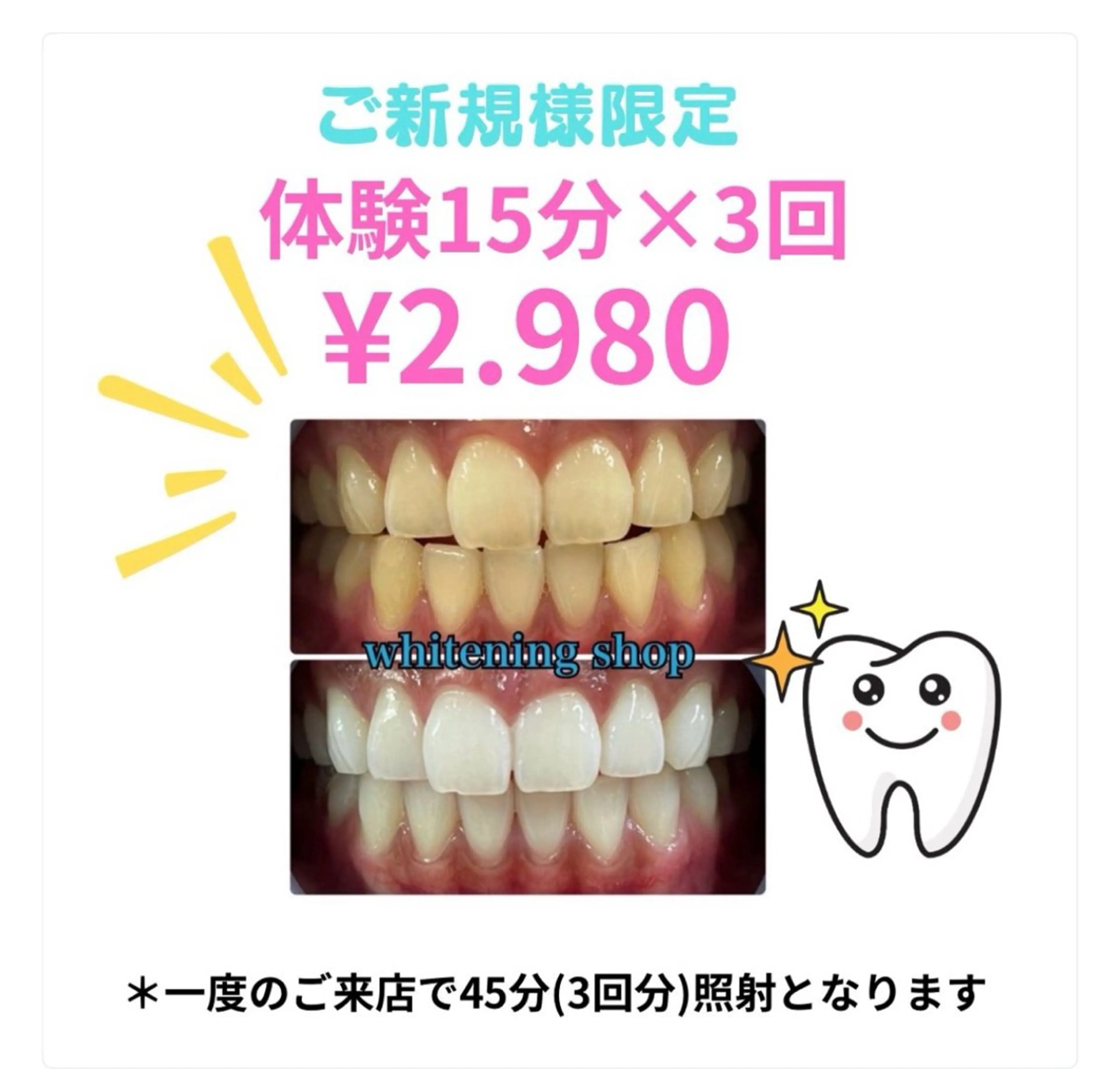 セルフ　ホワイト ニングショップ立川のその他イメージ