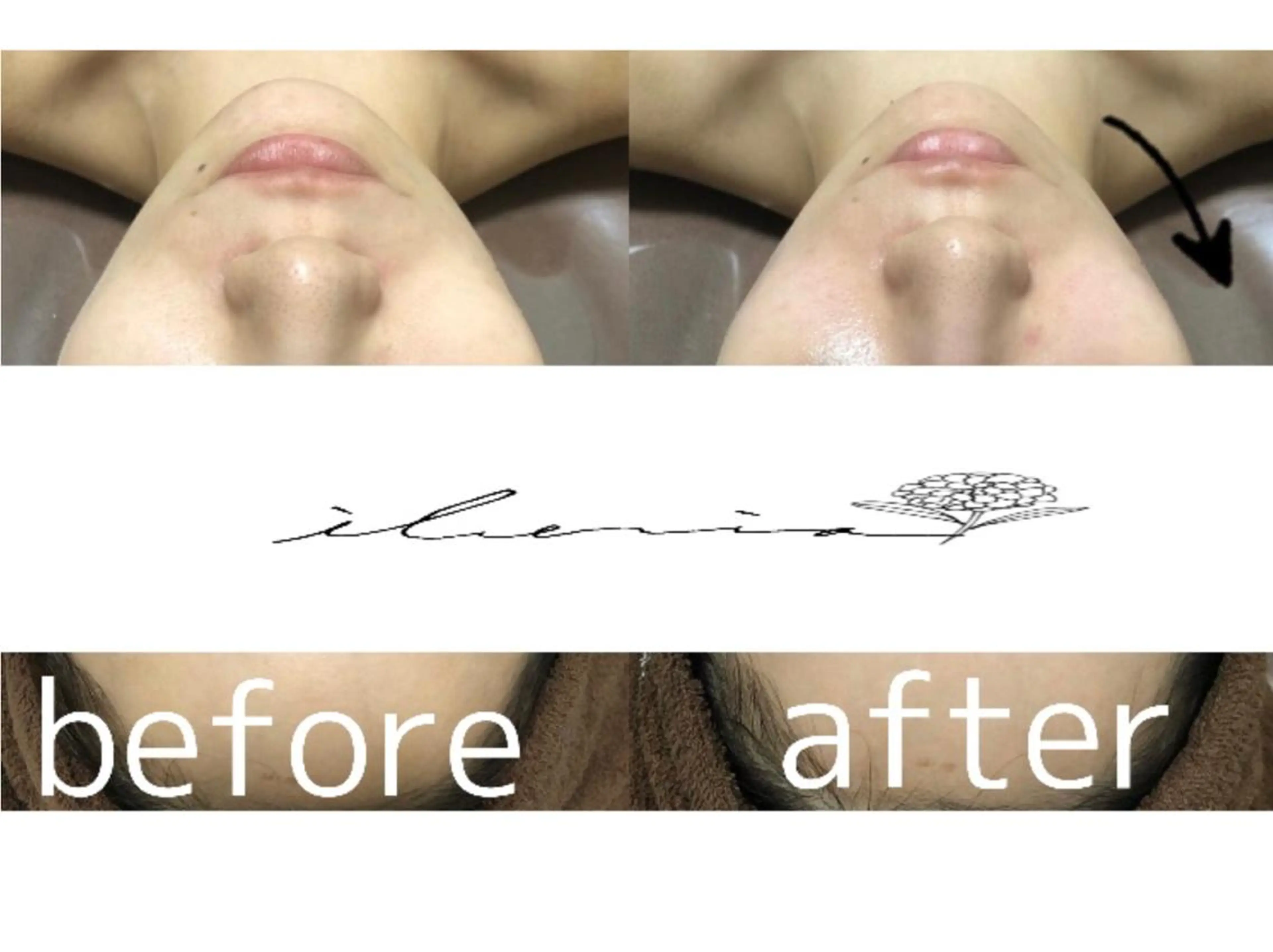 心斎橋痩身ダイエット 韓国.美容鍼.小顔のエステ・リラクイメージ