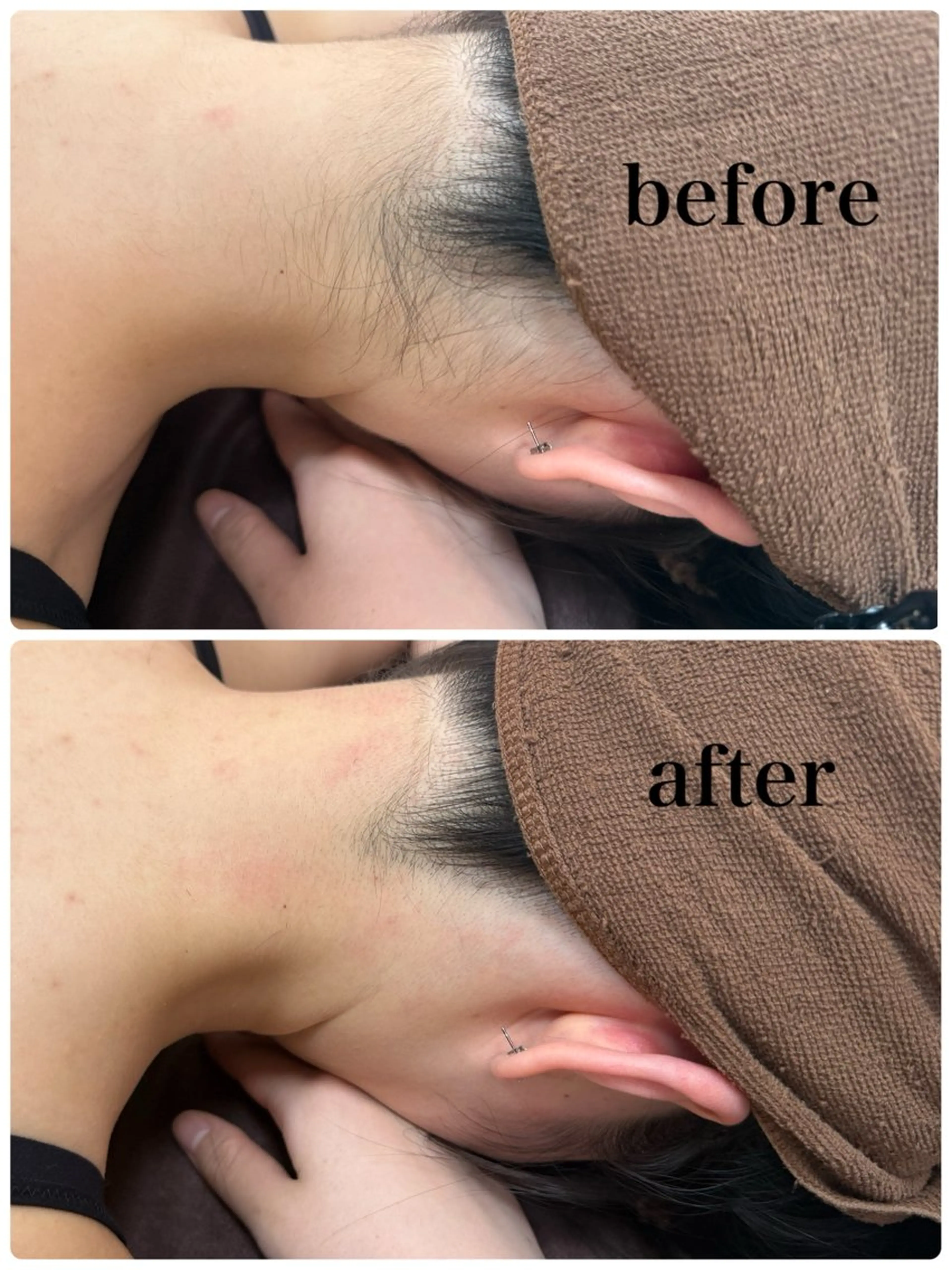 脱毛 ブリリエット 文山のエステ・リラクイメージ