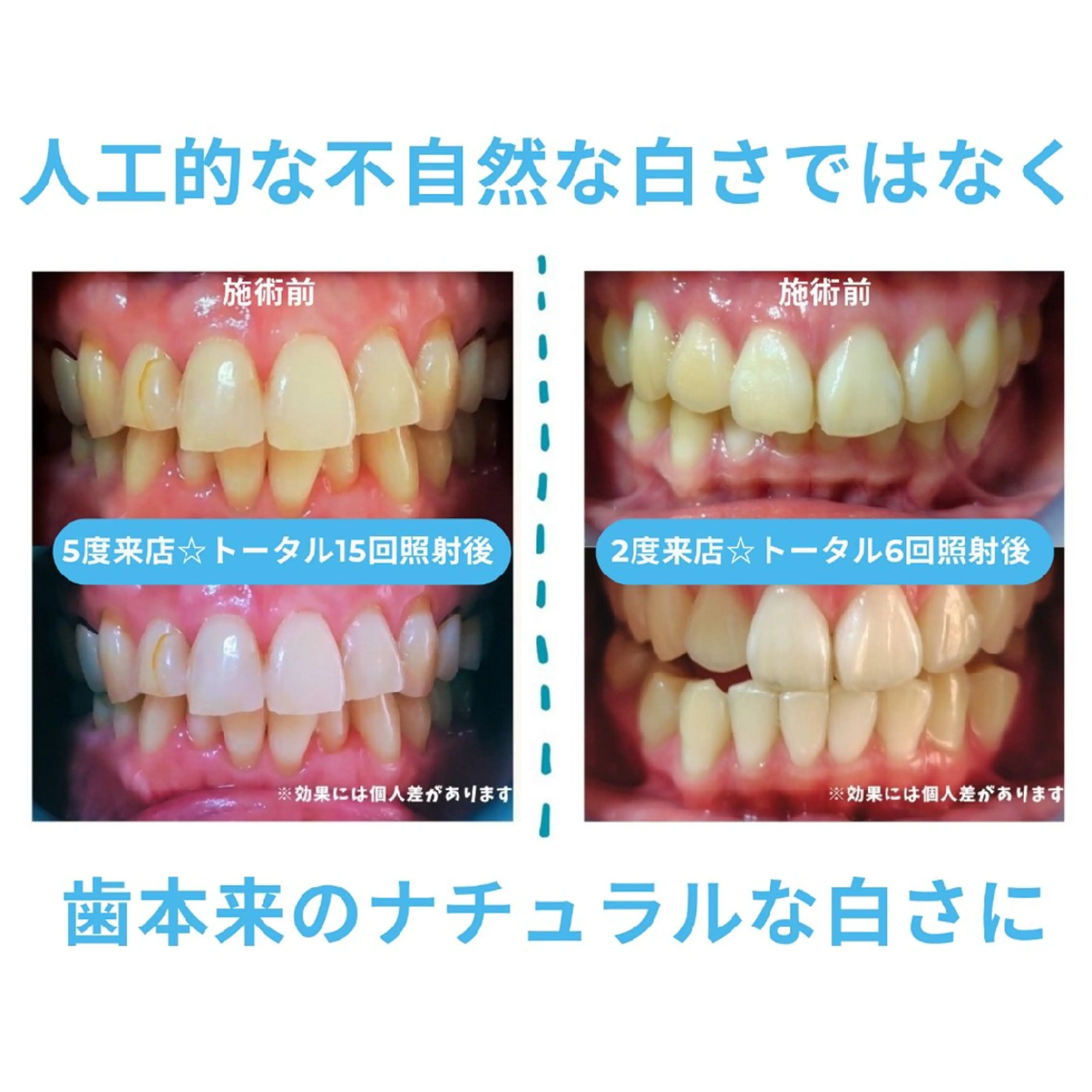 その他 ホワイトニングサロン ネージュ(女性専用)のその他イメージ