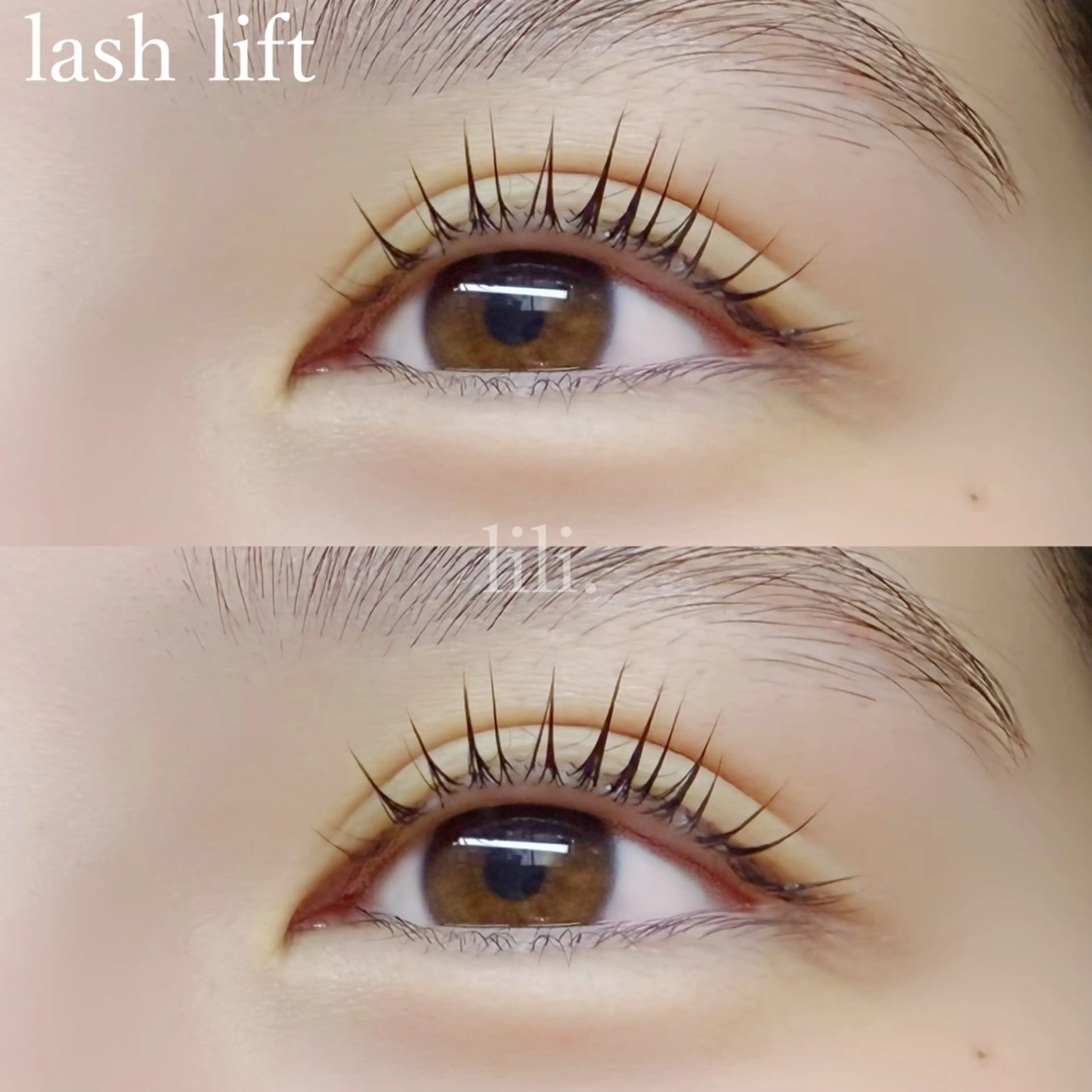 ใใใจใฏใปใใใ ใใใ ๐ ๐๐๐๐ ๐๐๐๐.ใฎใใใจใฏใปใใใใใถใคใณ