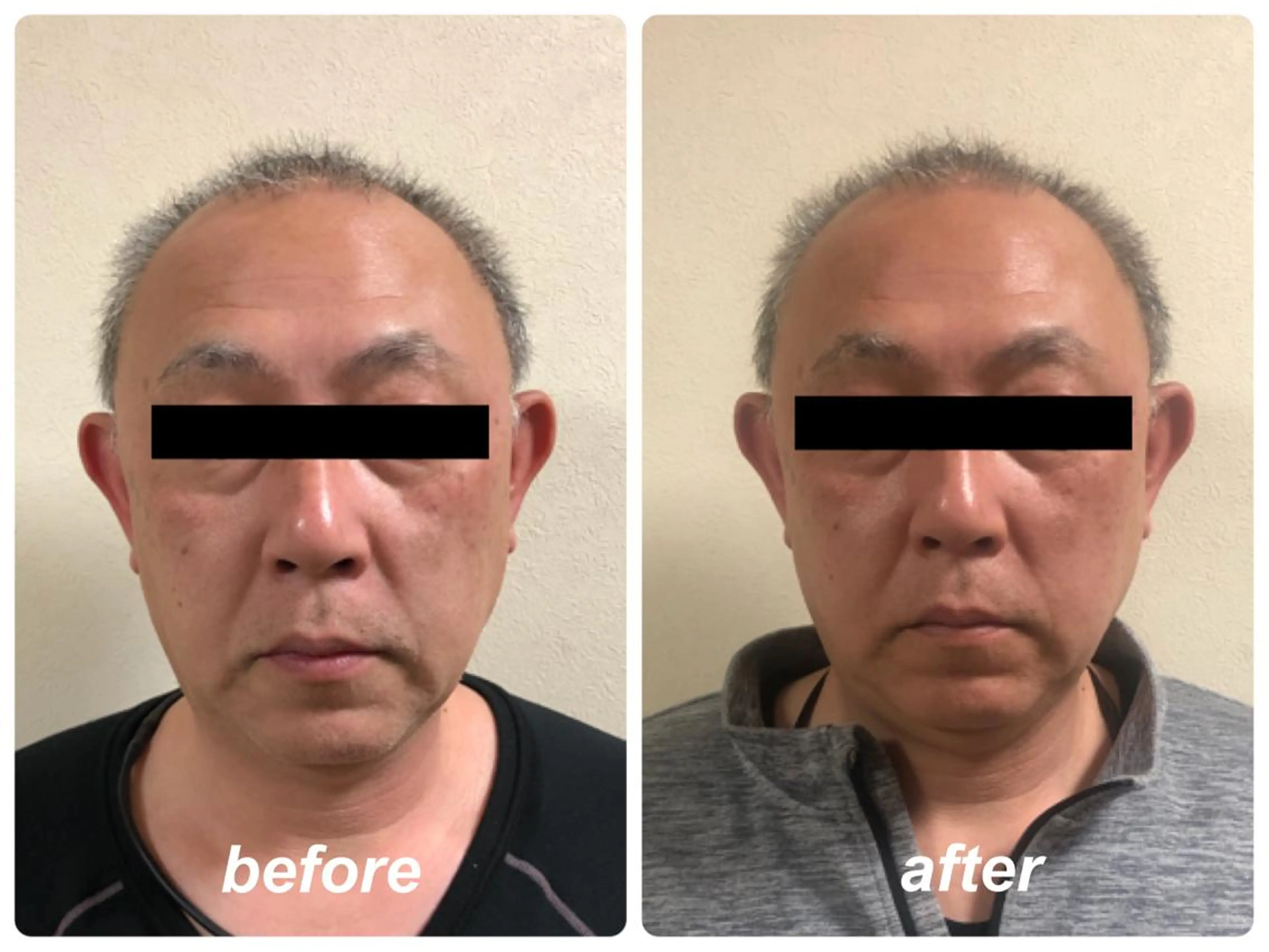 Radiance H.Oのエステ・リラクイメージ