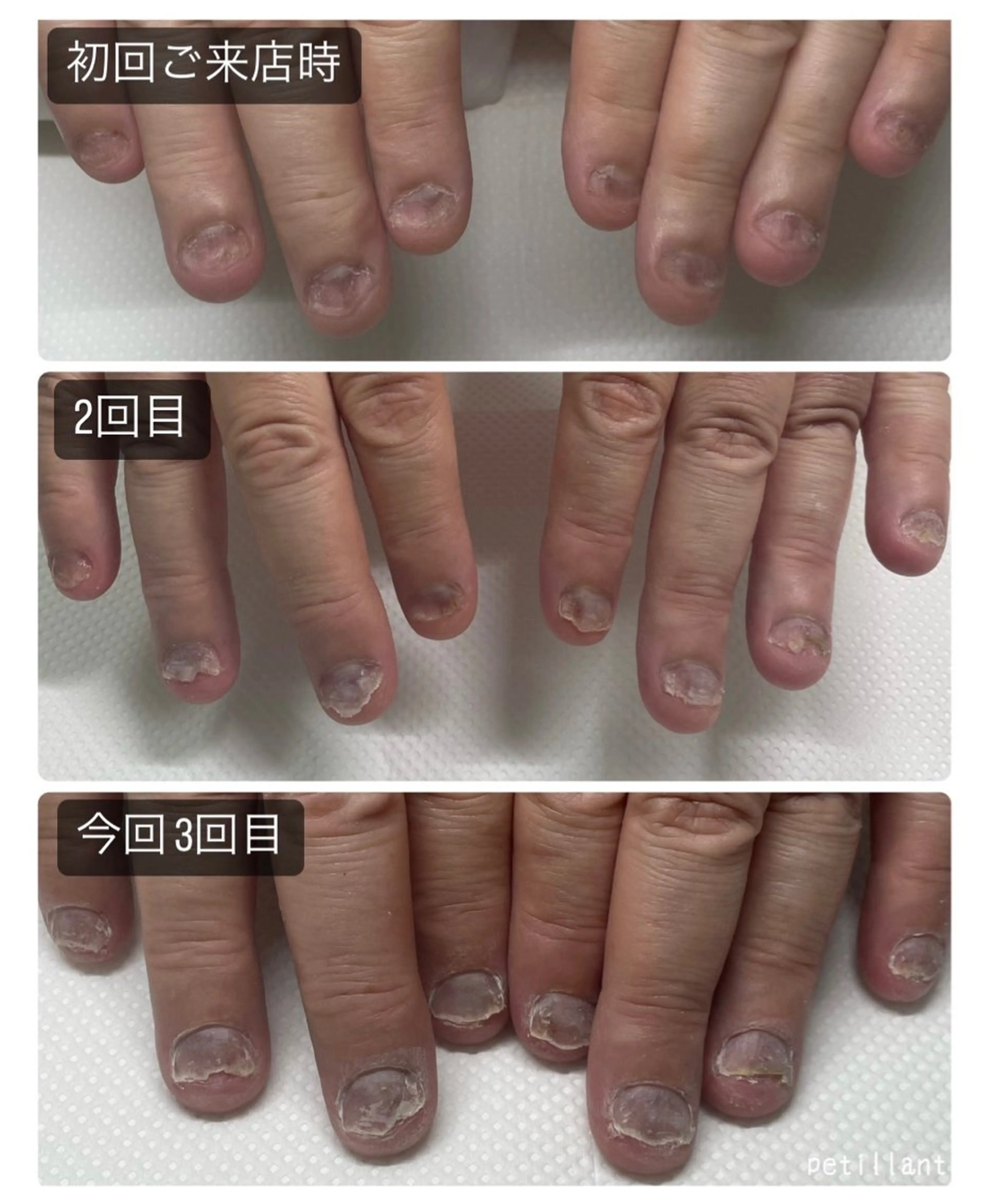 ネイル nail salon petillantのネイルデザイン