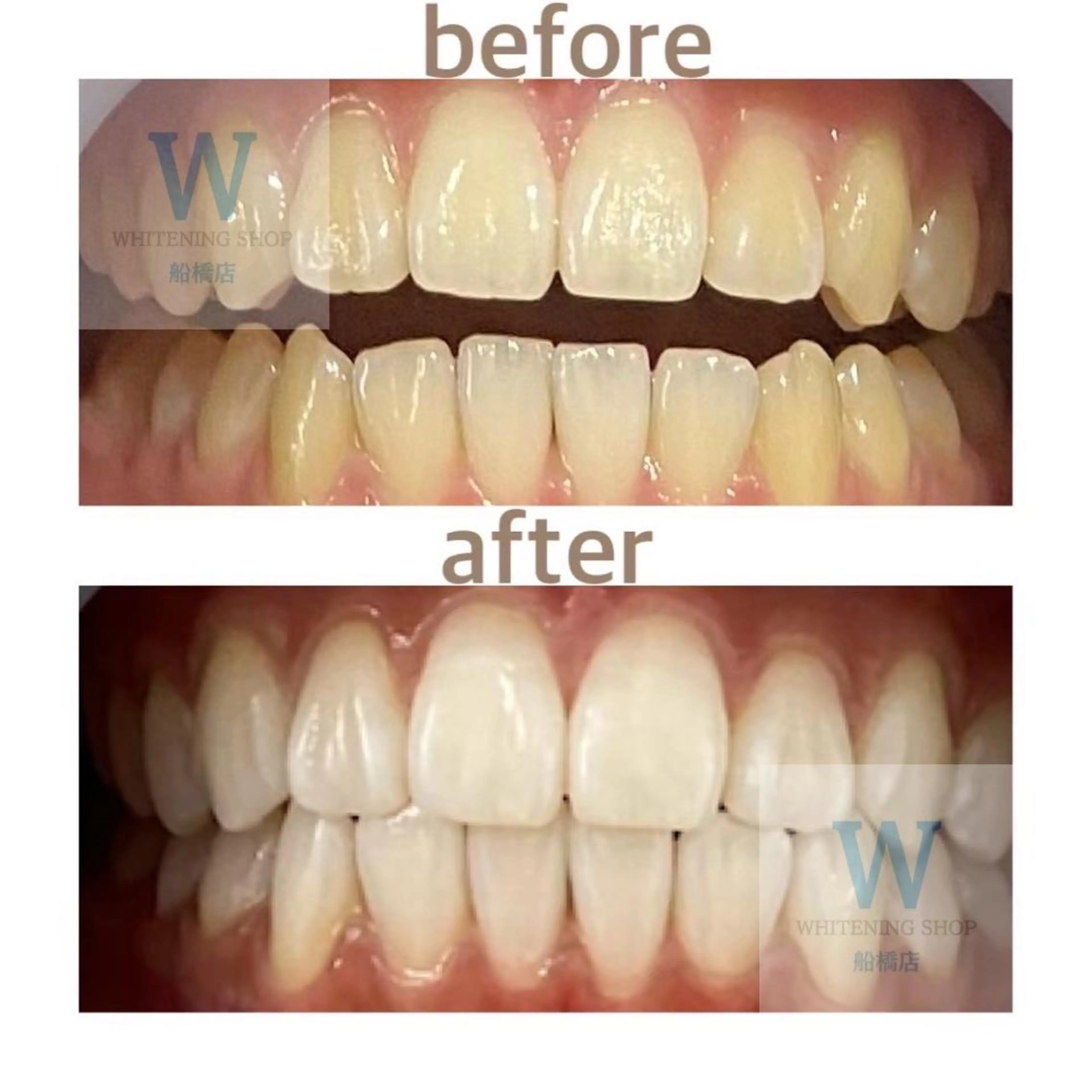 ホワイトニング ショップ船橋店🦷のエステ・リラクイメージ