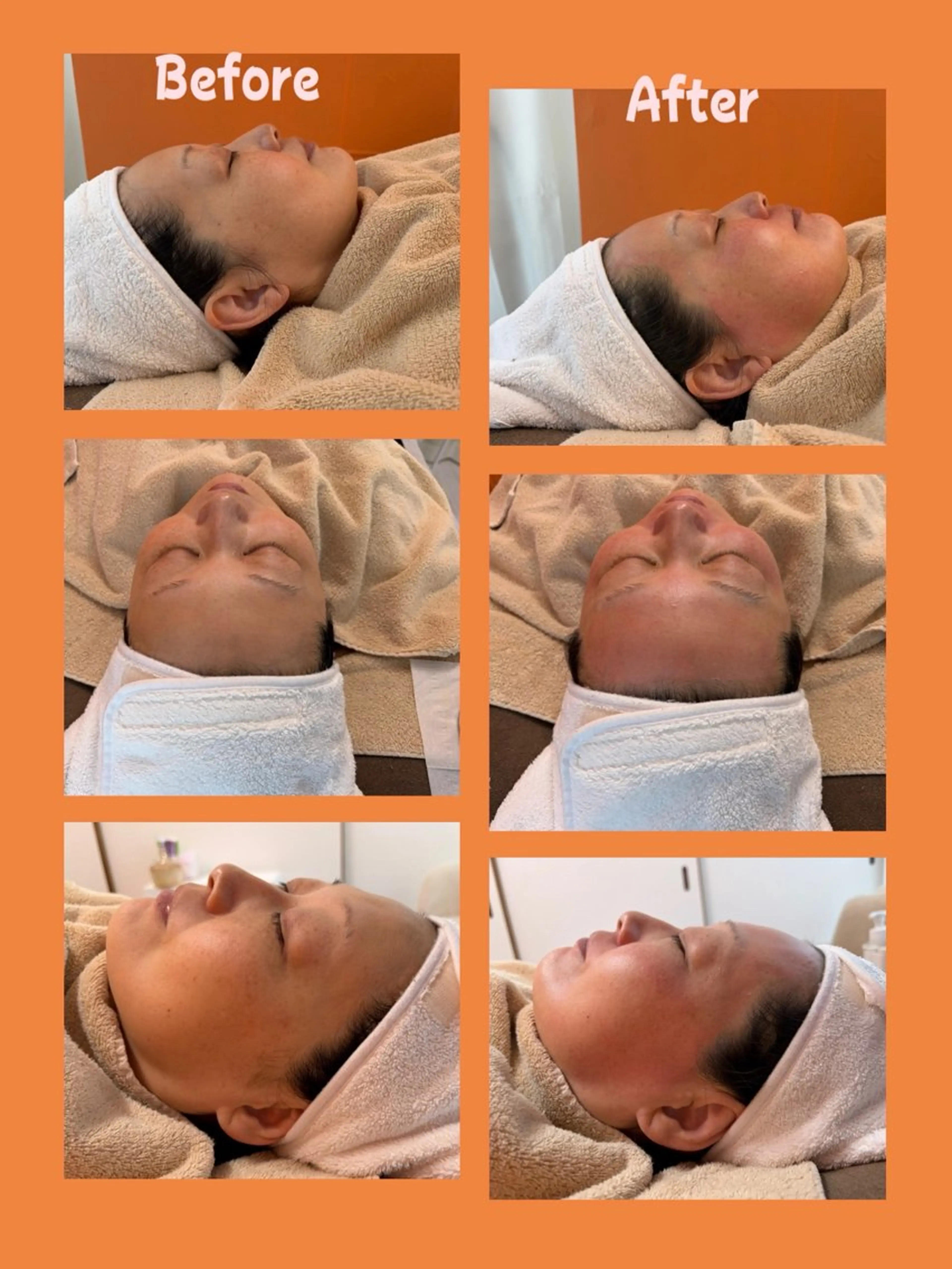 脱毛 Vonita Mikieのエステ・リラクイメージ