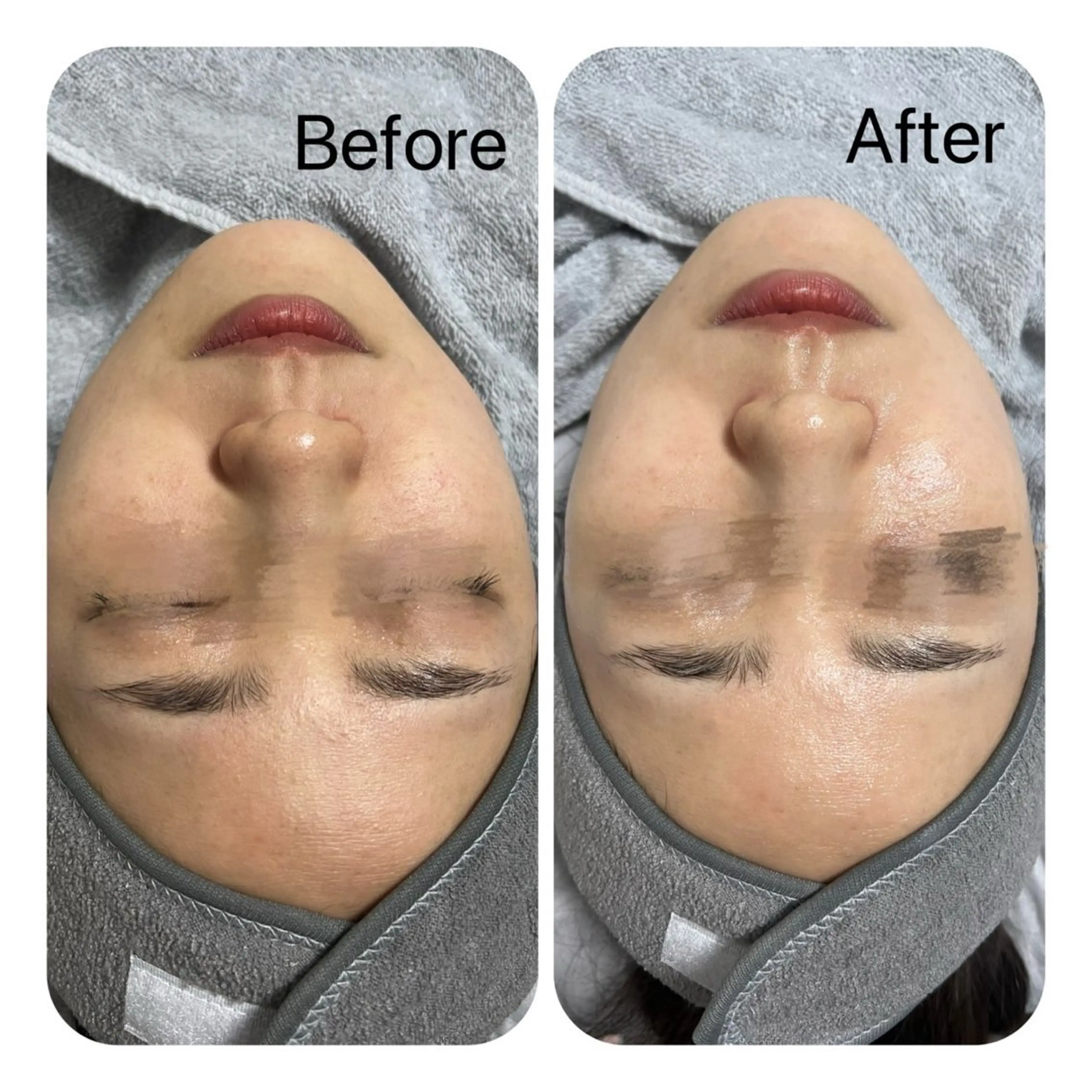 エステ Éclat de Belle🫧白玉肌のその他イメージ