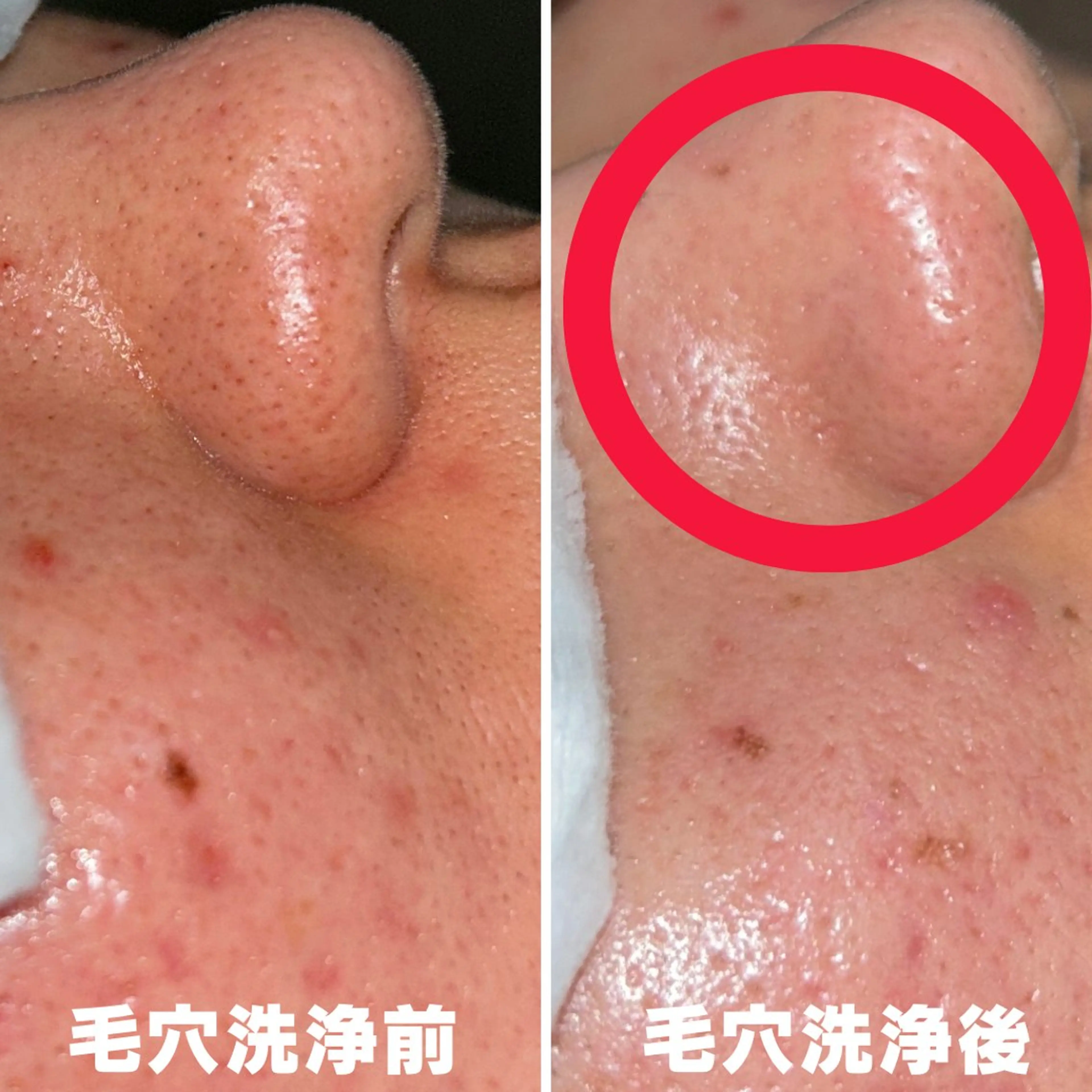 素肌まで綺麗に✨メンズ清潔感メニューの写真