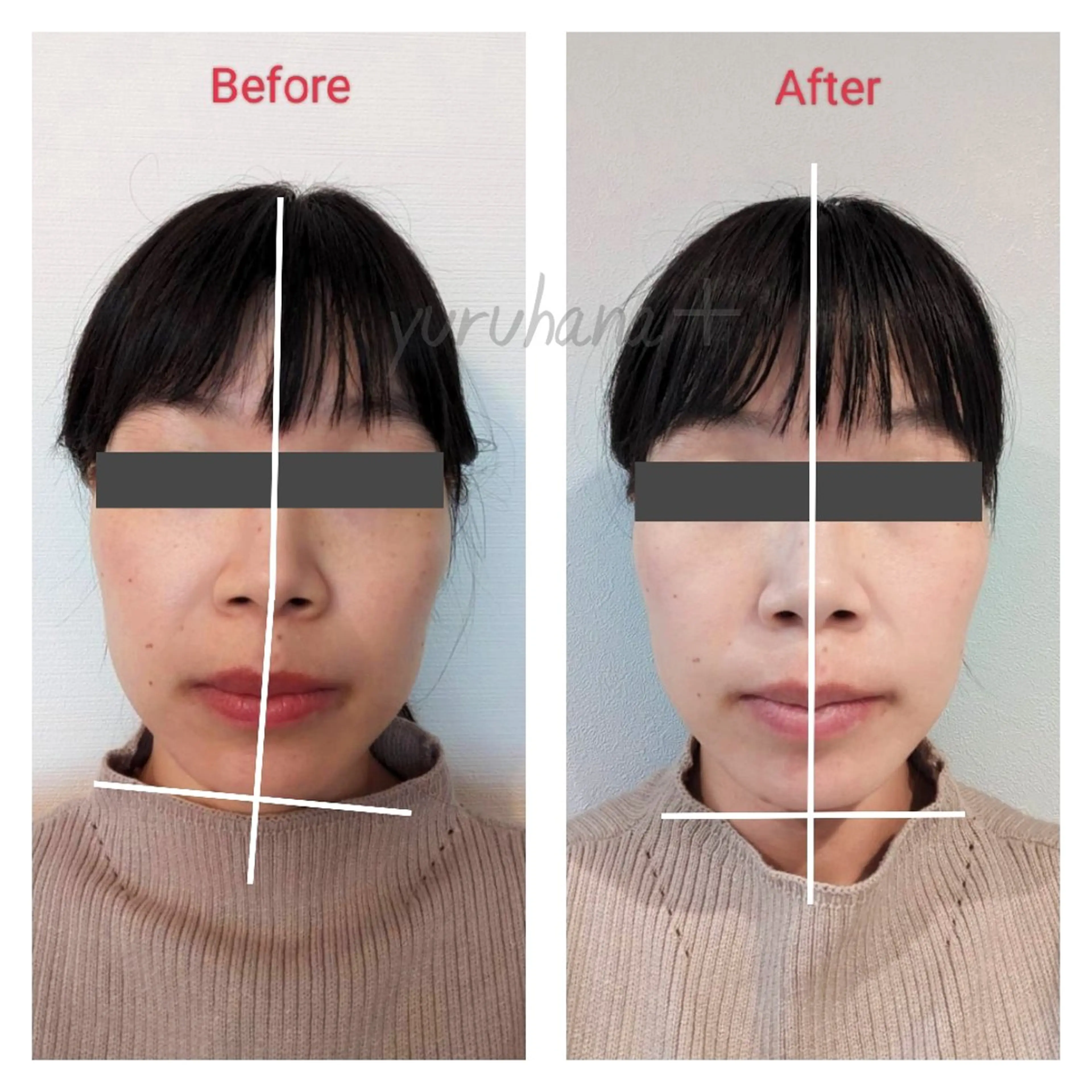 小顔矯正&足つぼサロン　yuruhana所属・小顔矯正&足つぼ yuruhanaのエステ・リラクイメージ