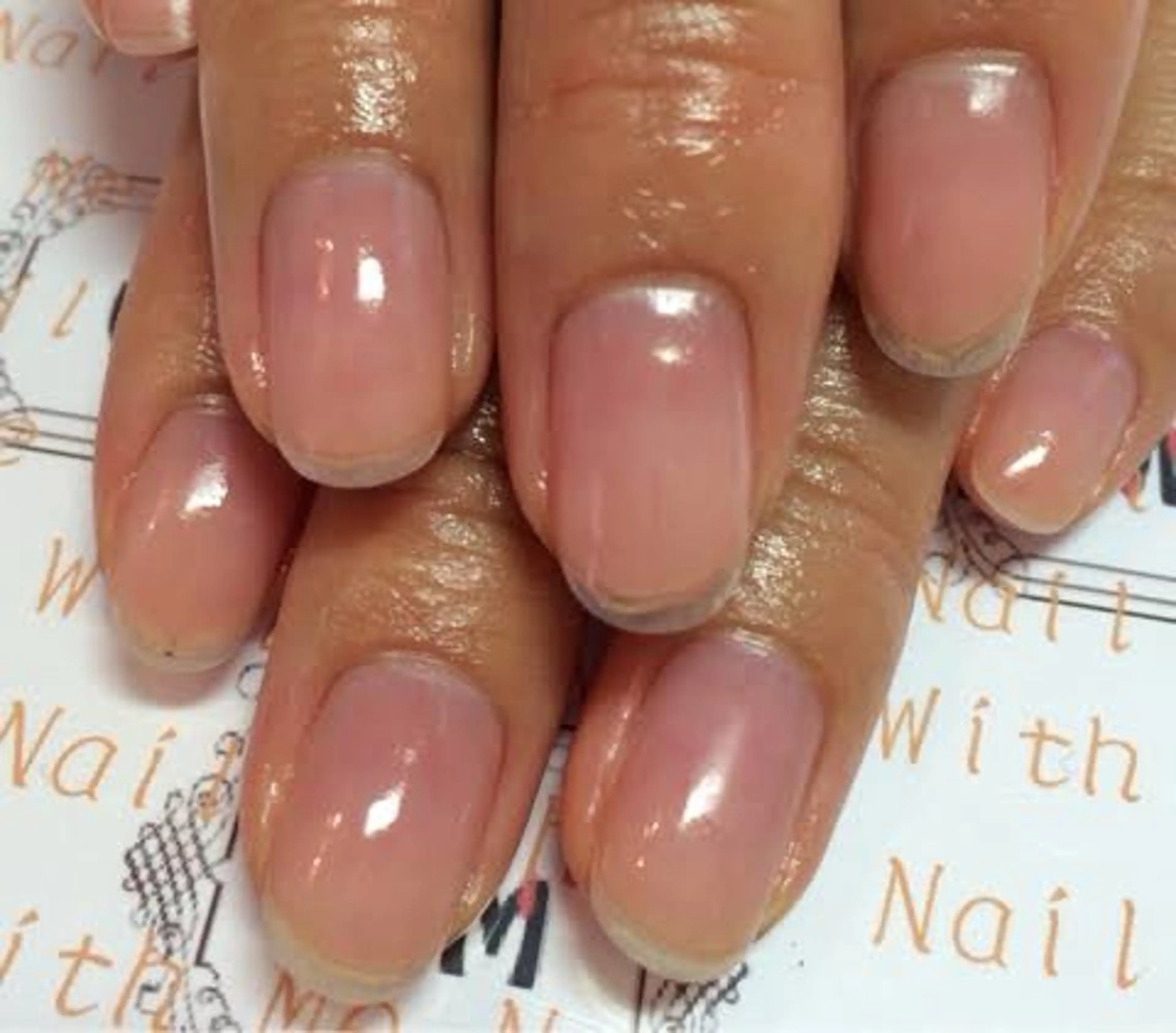 ソフトジェルオフの写真