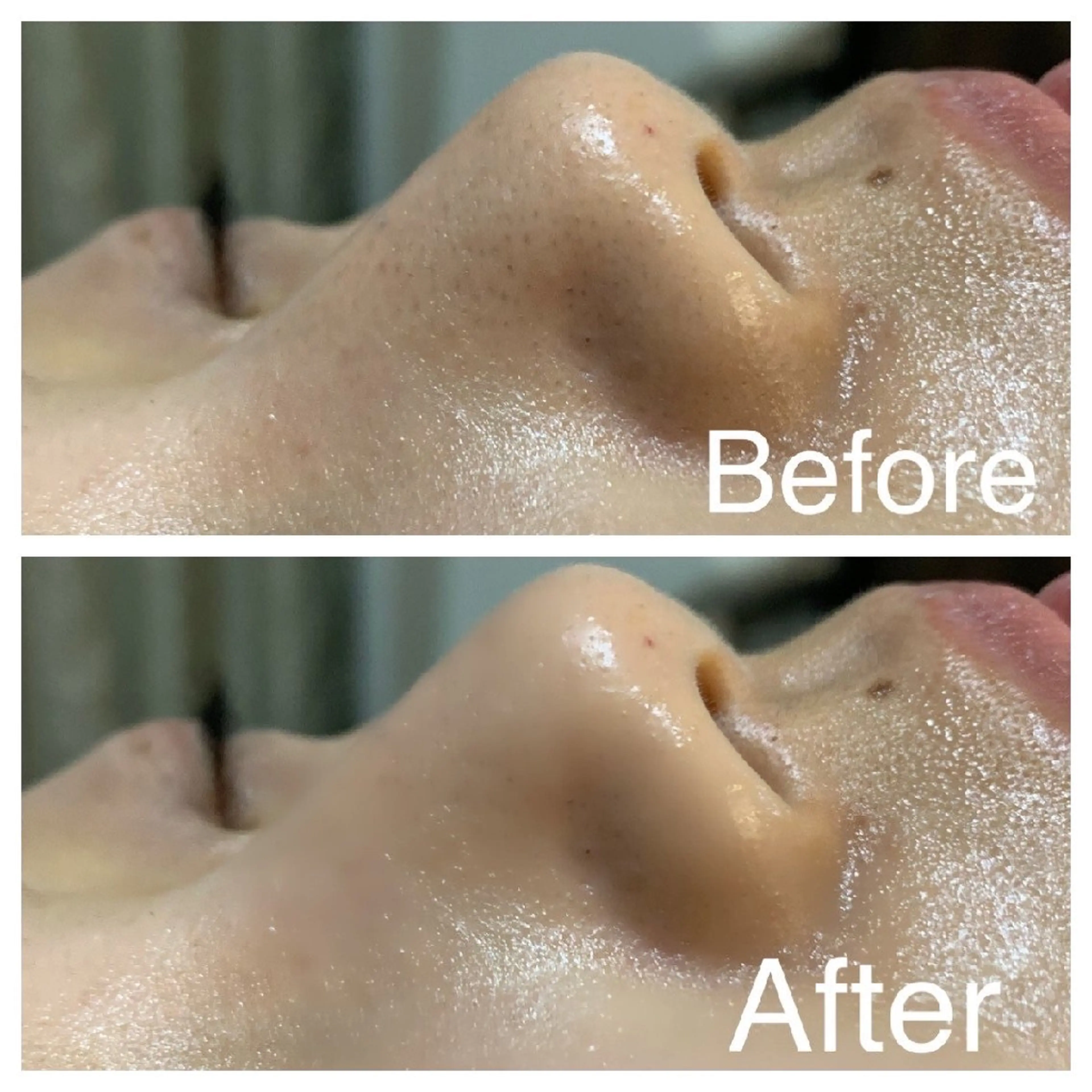 🍁美Plus下北沢 肌質改善/まつ毛のマツエク・マツパデザイン