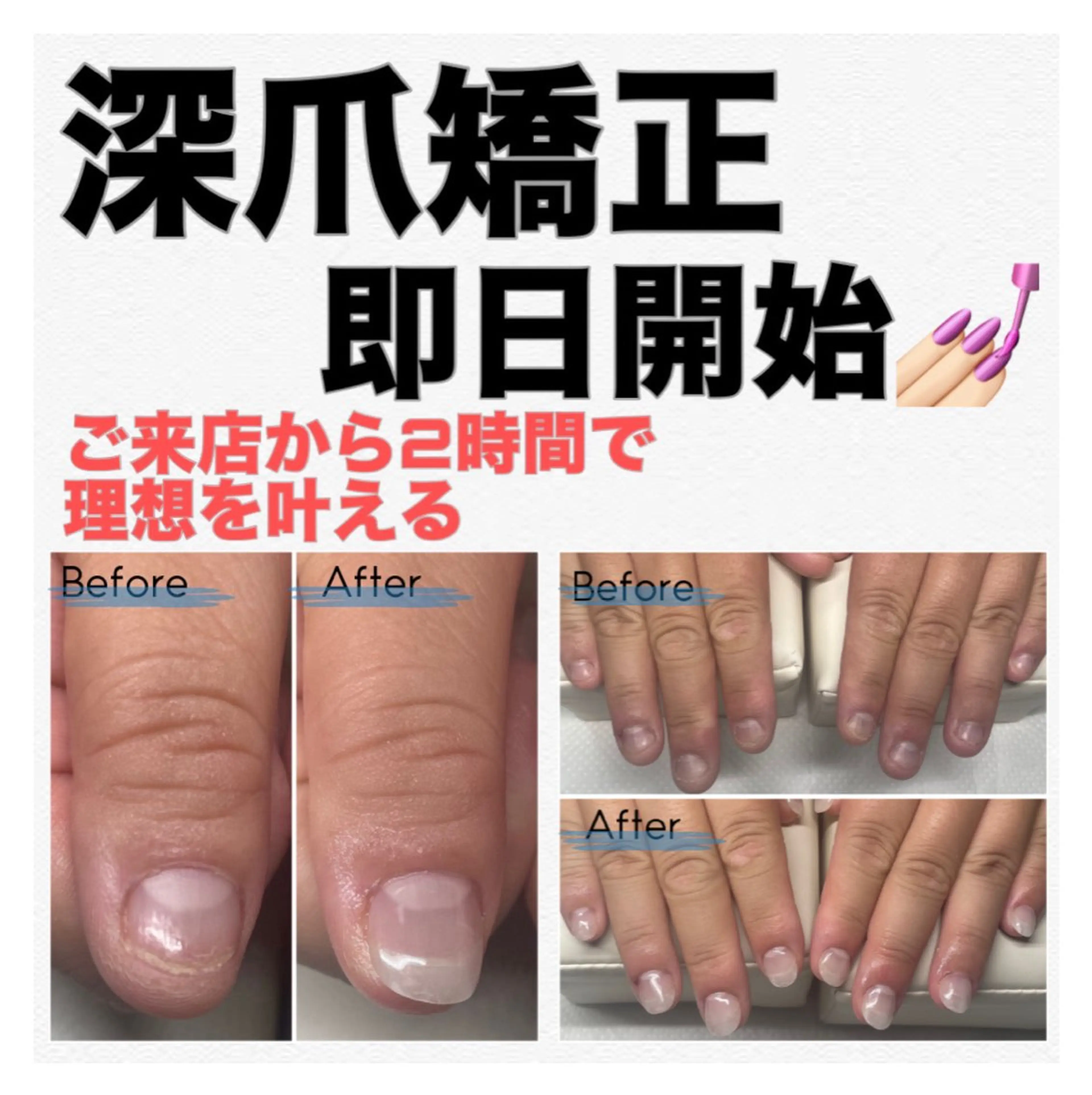 ネイル クリアネイル 長さ出し ハンドネイル ハンドケア nail salon petillantのネイルデザイン