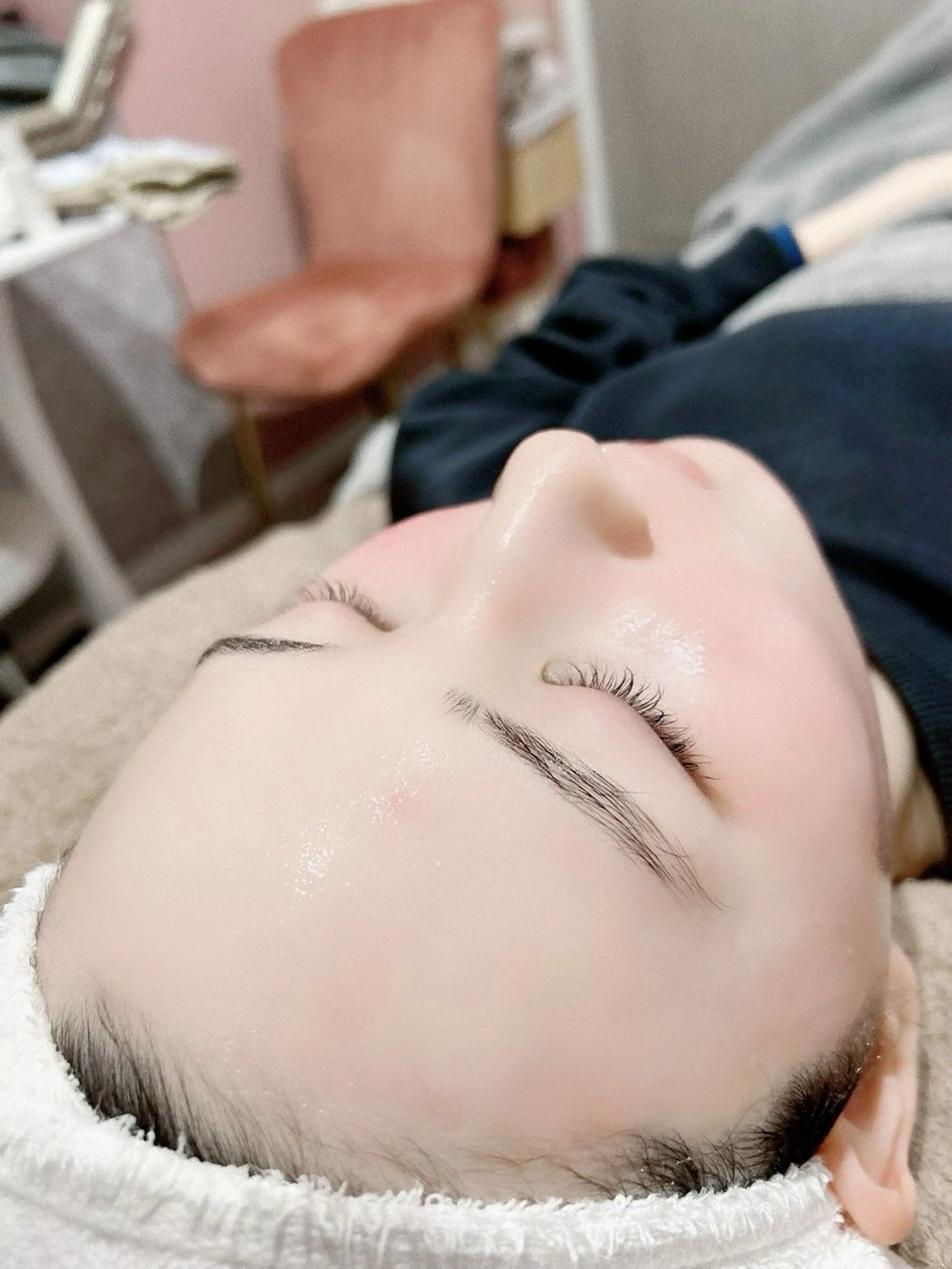 【スピード🆙技術向上モデル】タマゴ肌お顔ツルツル！顔脱毛フェイシャルWAX♥️の写真