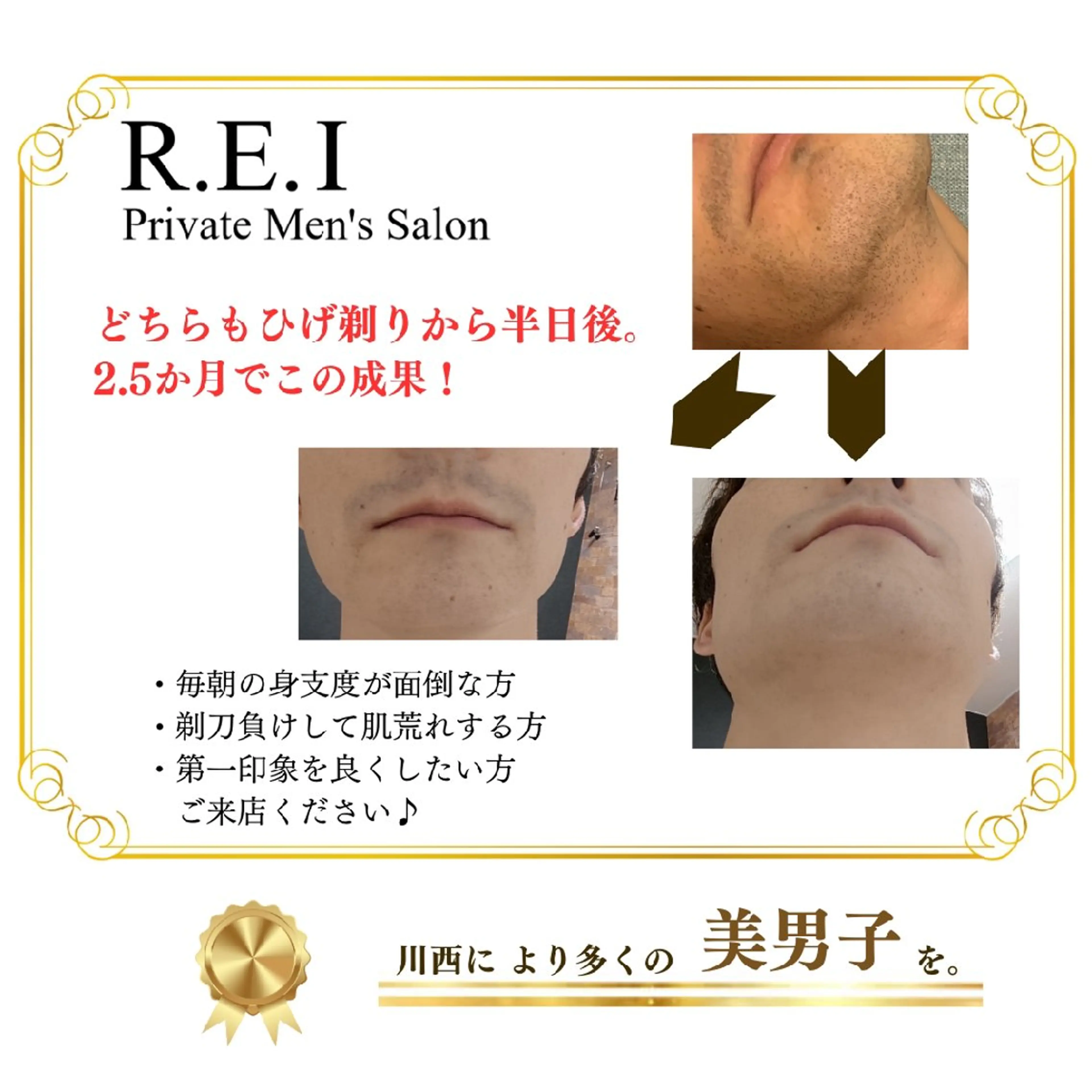 メンズ R.E.I　大学生 急増中！U22割有りのエステ・リラクイメージ