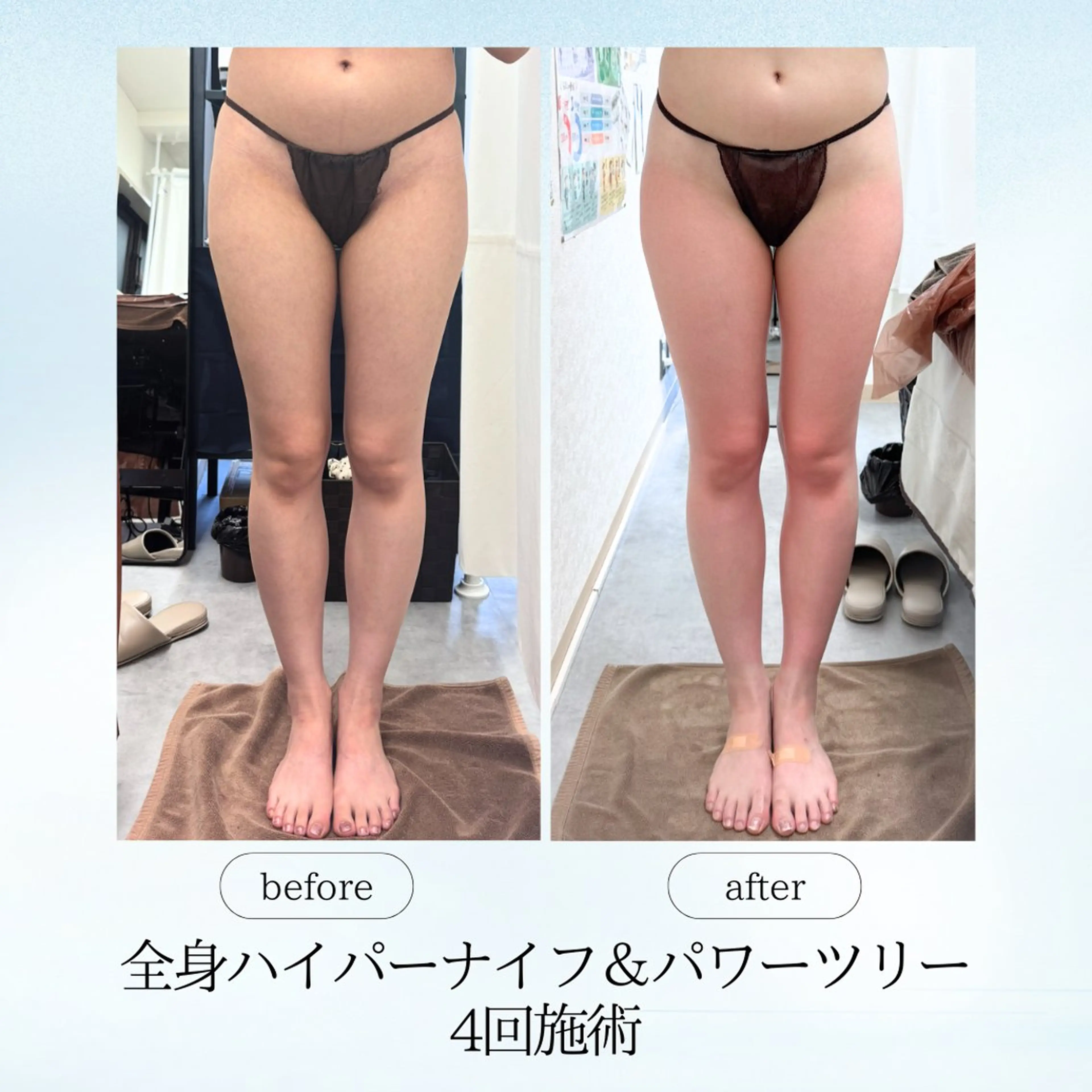 エステ リラク 《痩身、小顔専門店》 エスプレッソのエステ・リラクイメージ