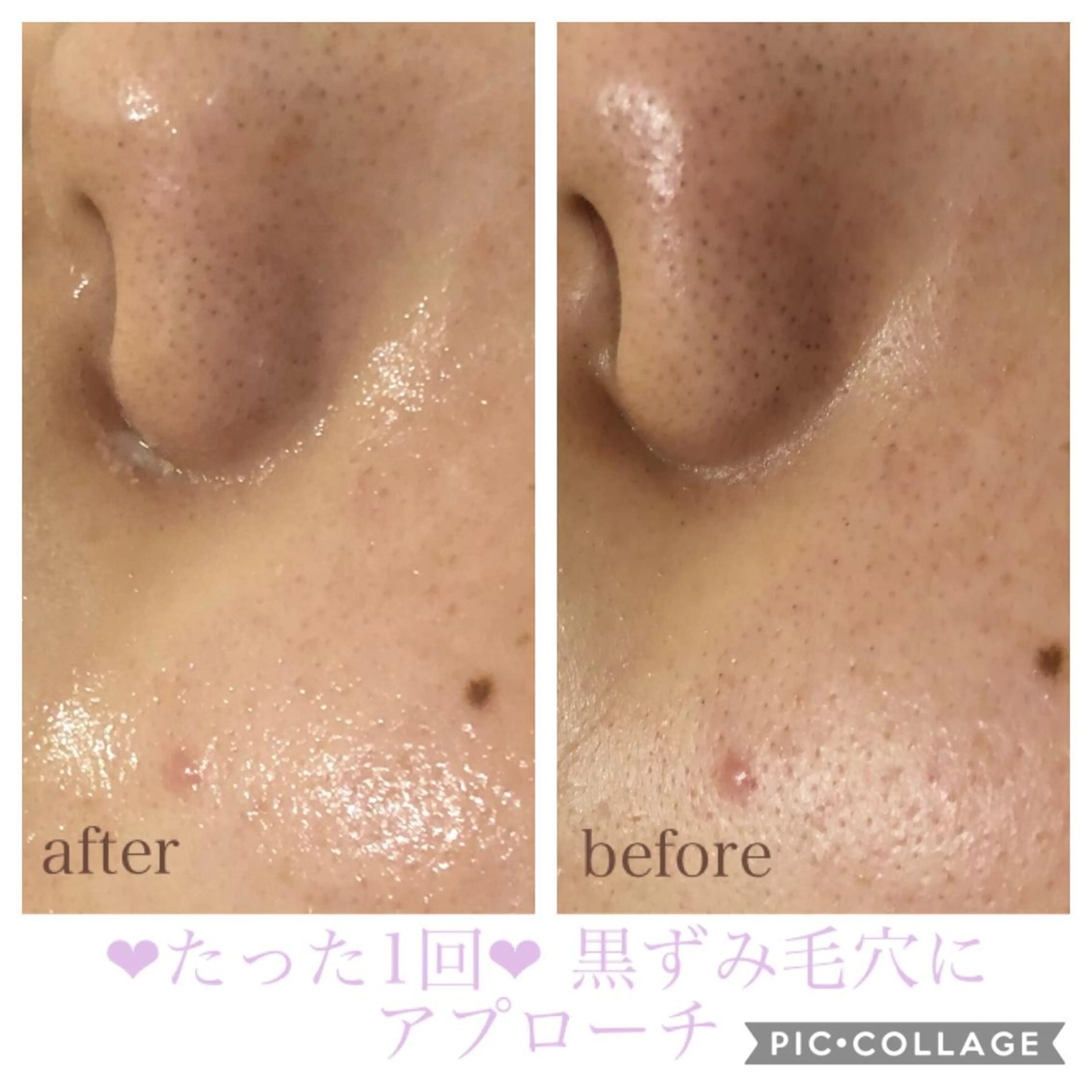 ショート カラー パーマ ヘアアレンジ キッズ ネイル マツエク・マツパ エステ リラク EnsorClair 代表 野口真央のエステ・リラクイメージ