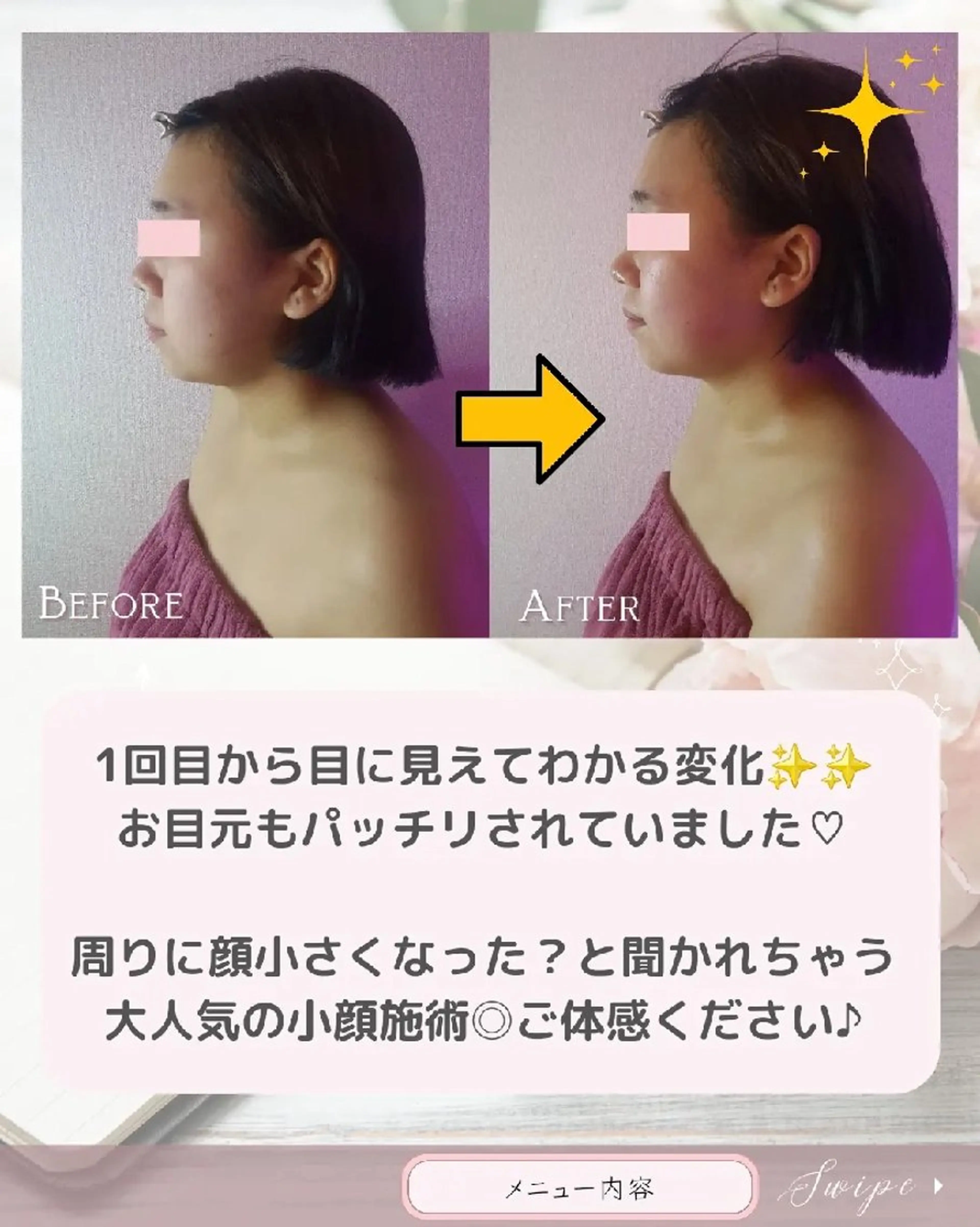 痩身ハーブピーリング 筋膜リリース☆B&Hのエステ・リラクイメージ