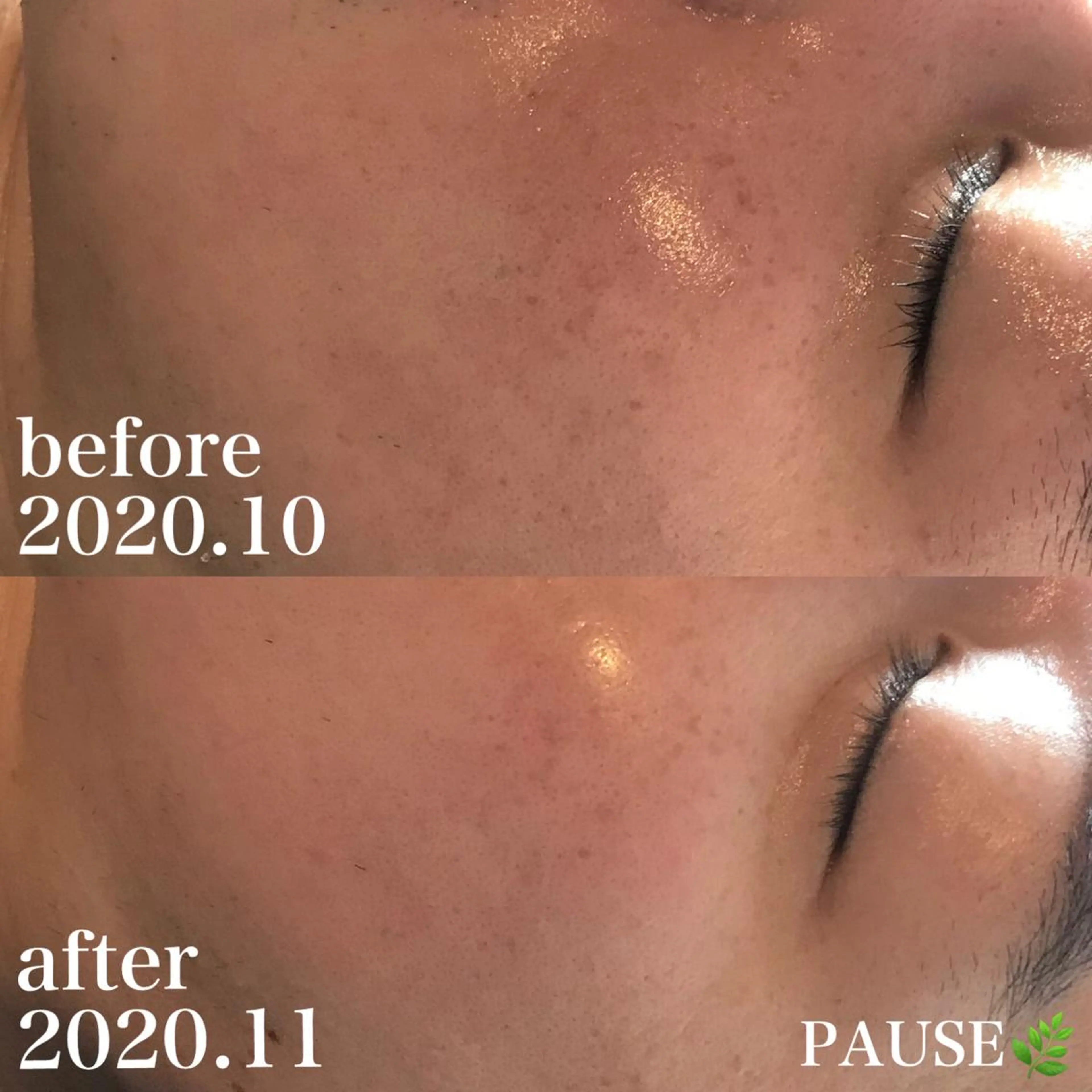 エステ 浜野 恵美のエステ・リラクイメージ