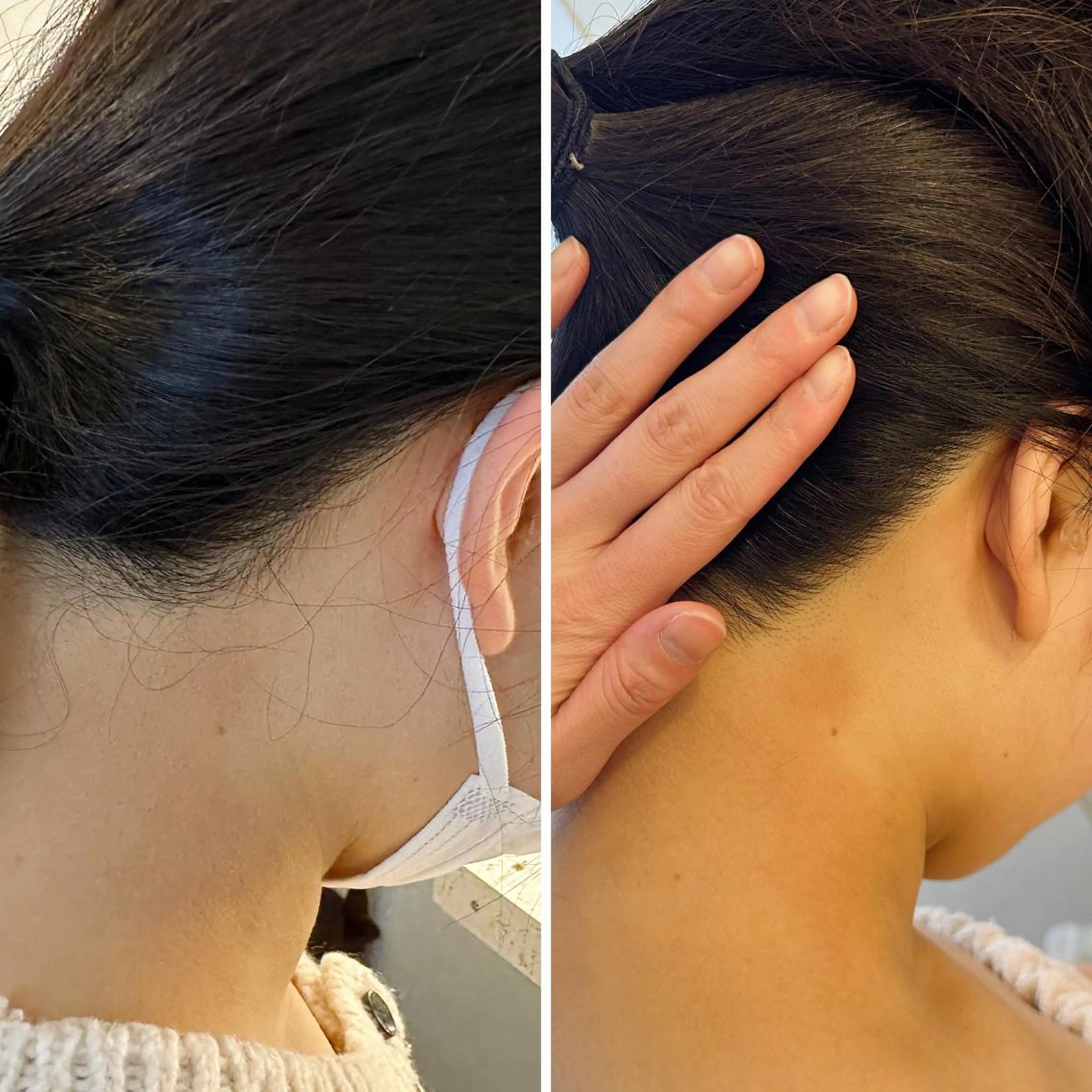 脱毛 うなじ脱毛/美肌脱毛 LABELのエステ・リラクイメージ