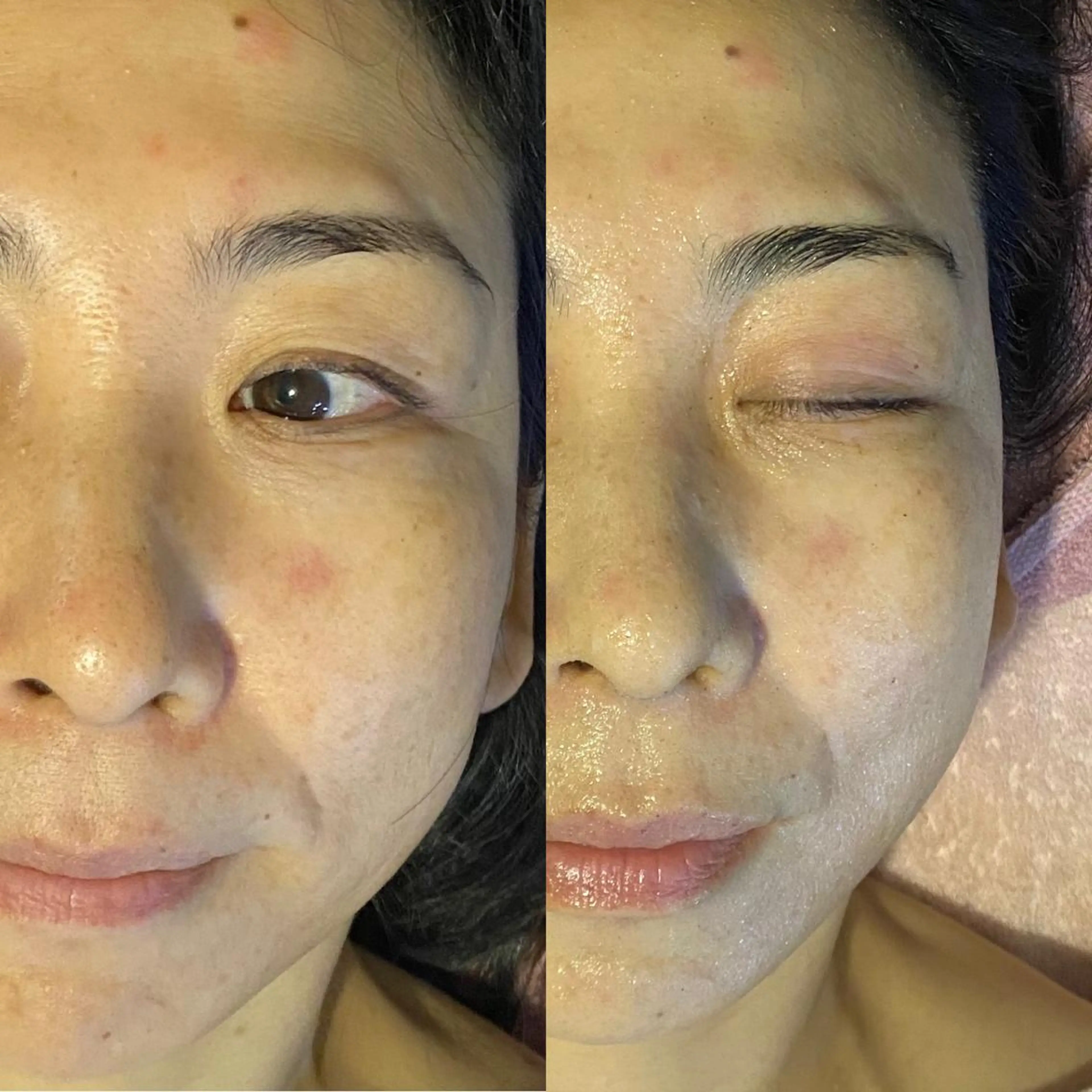 Meetite 小林のエステ・リラクイメージ