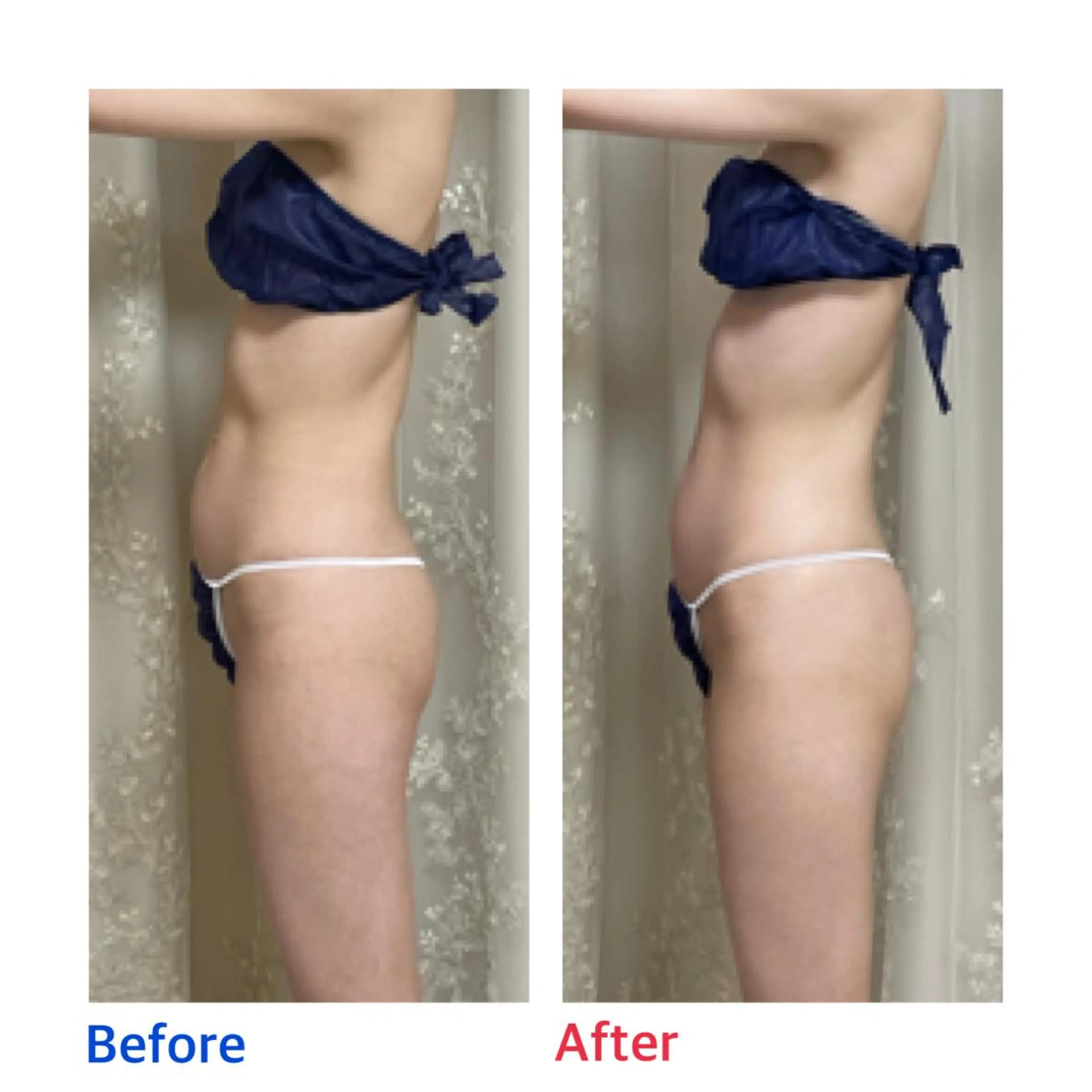 エステ リラク プライベートサロン moyoのエステ・リラクイメージ