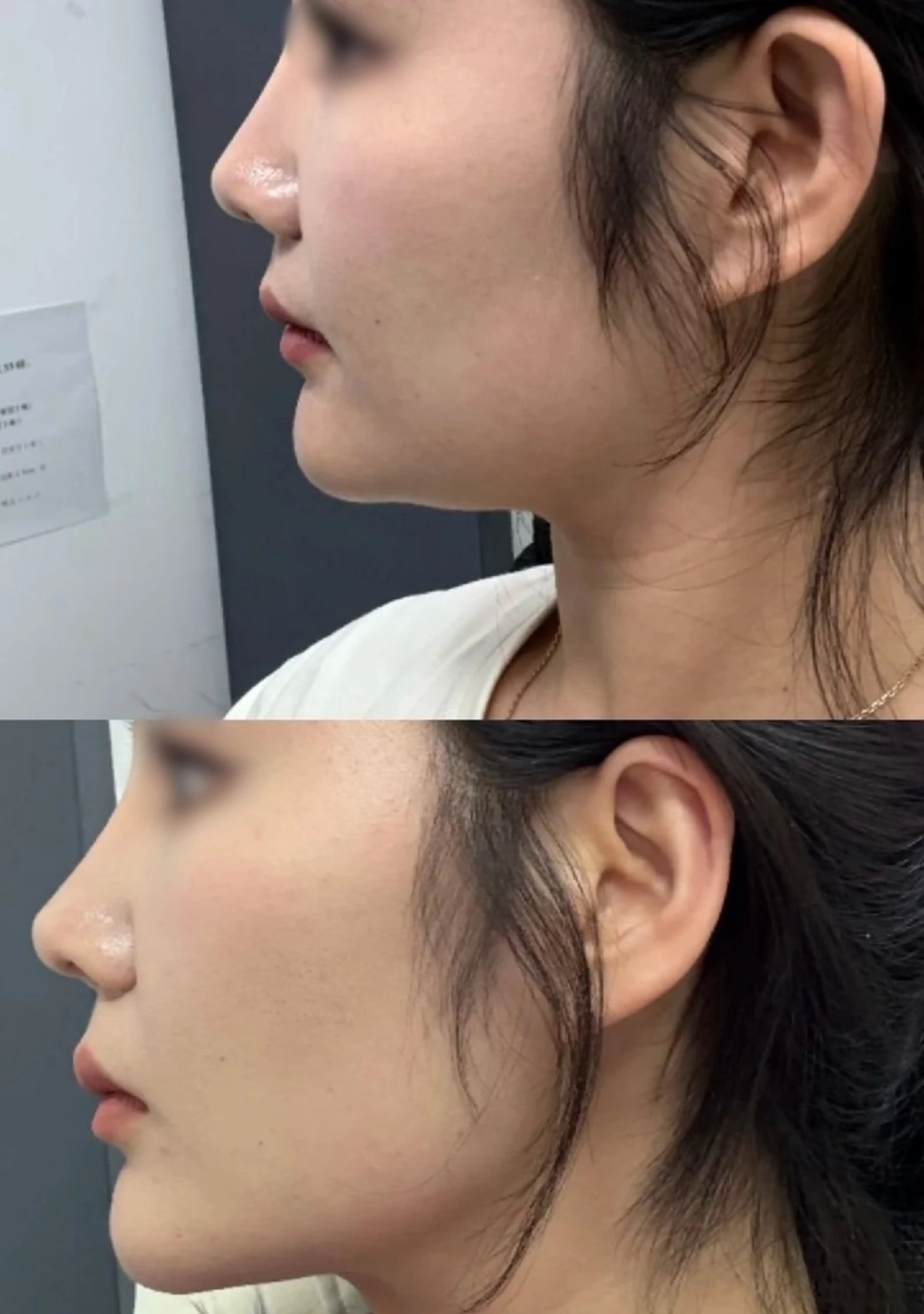 マツエク・マツパ 結婚式・ブライダル aliaハーブ水光店 エステティシャン募集のエステ・リラクイメージ