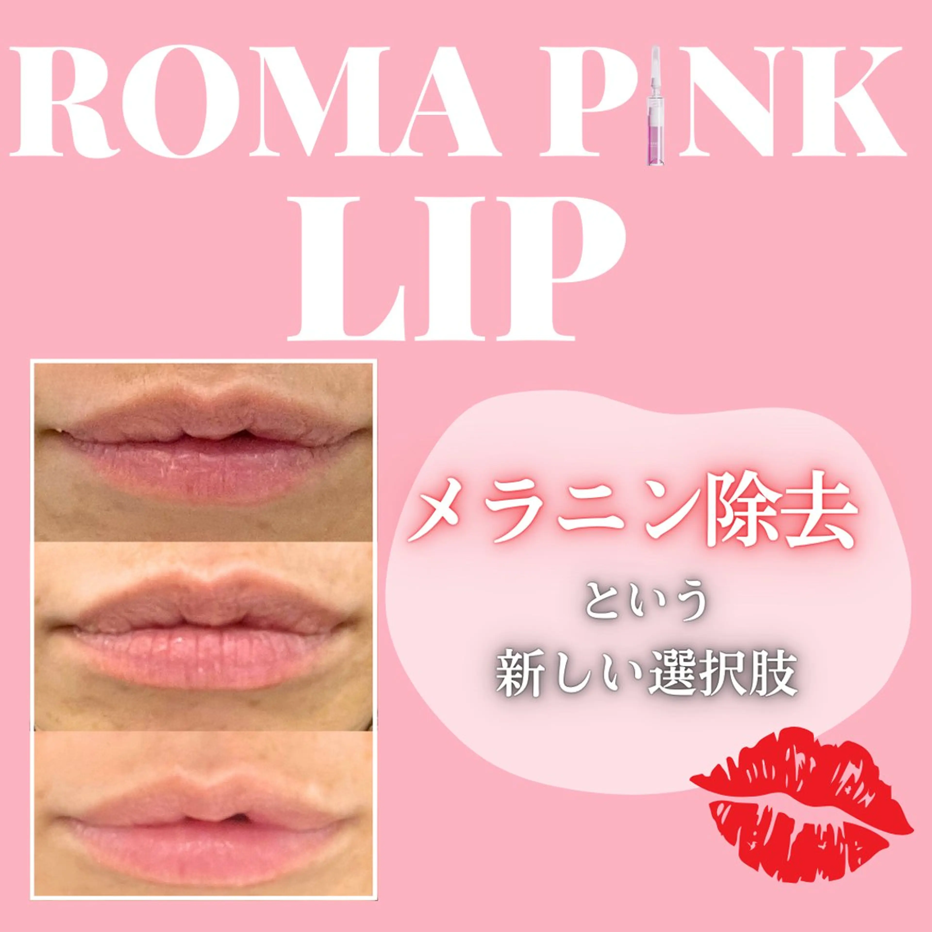 OAK×NACHUL 成城学園前のエステ・リラクイメージ