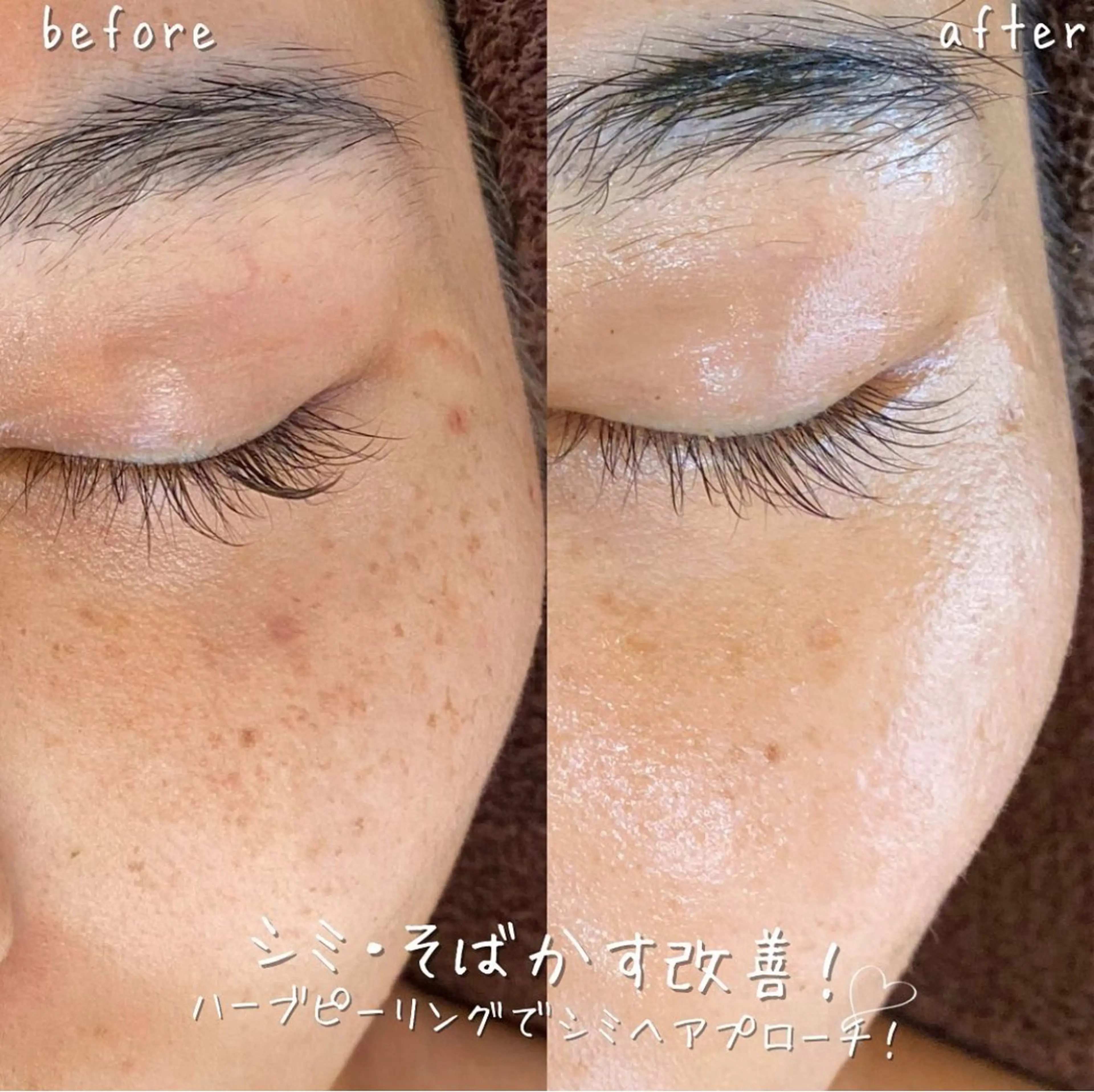 NA skin たまプラーザ　川島のエステ・リラクイメージ