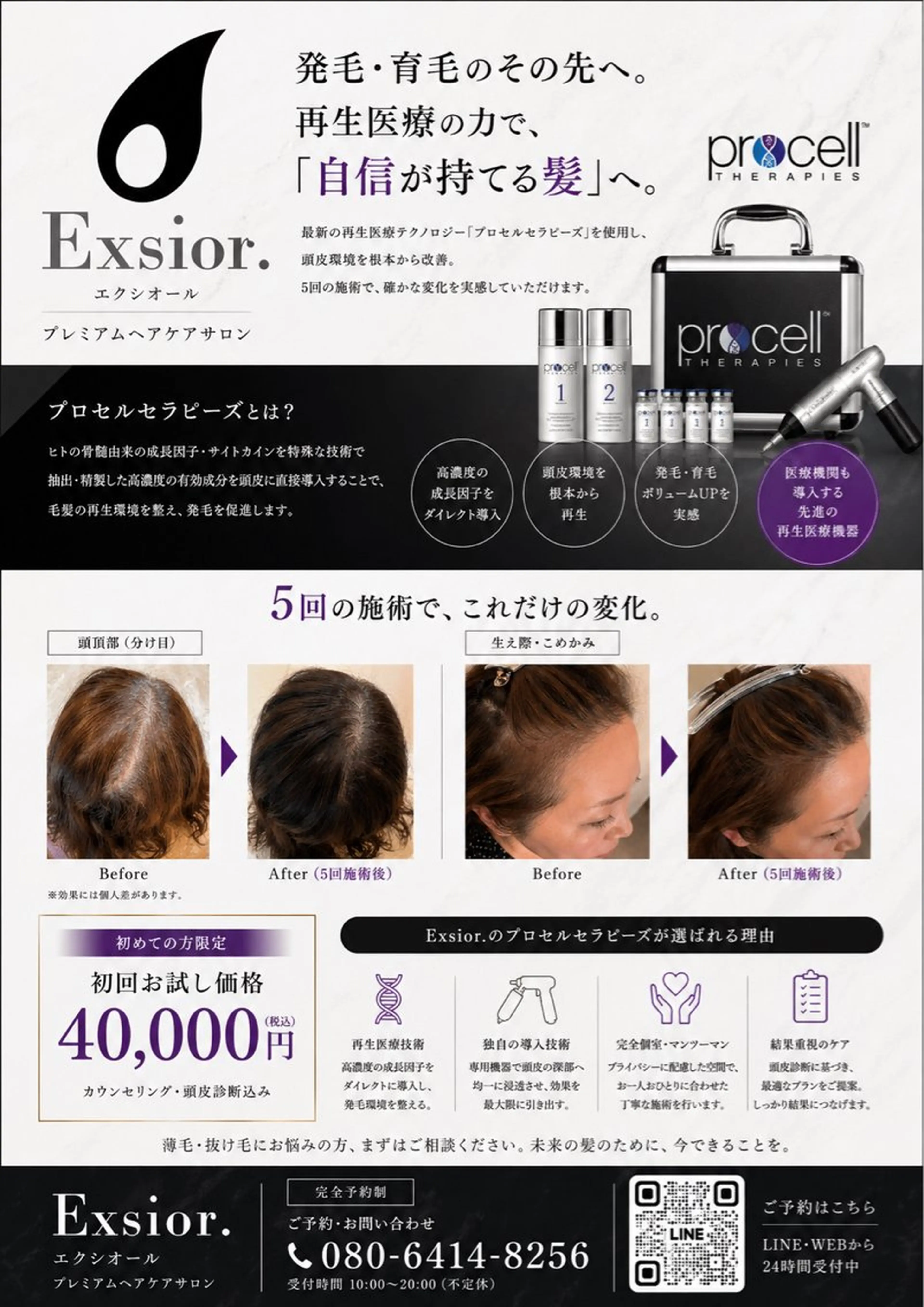 その他 脱毛サロン Exsior.博多店の眉毛・アイブロウイメージ