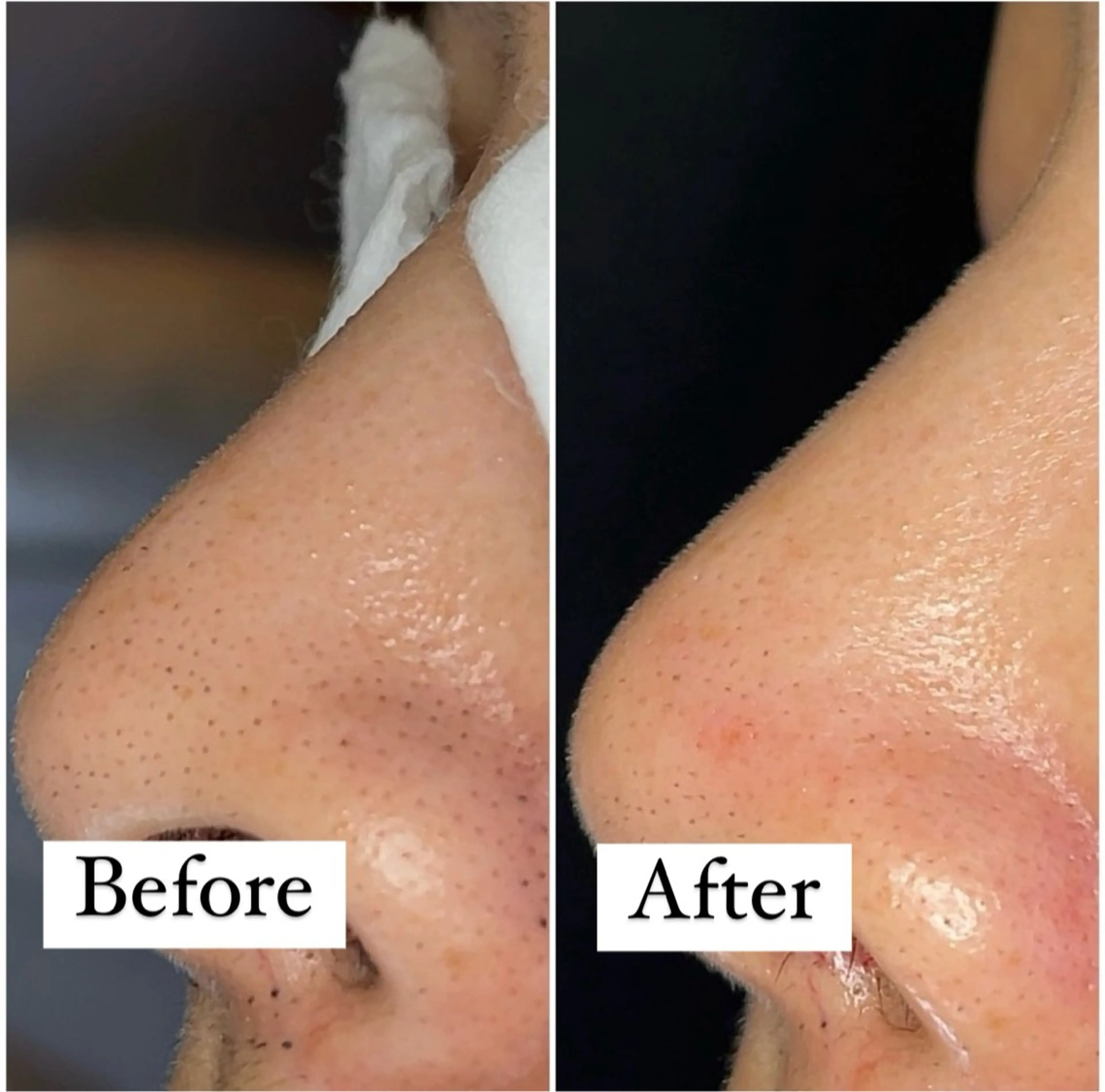 エステ リラク エステサロン Y.GRACEのエステ・リラクイメージ