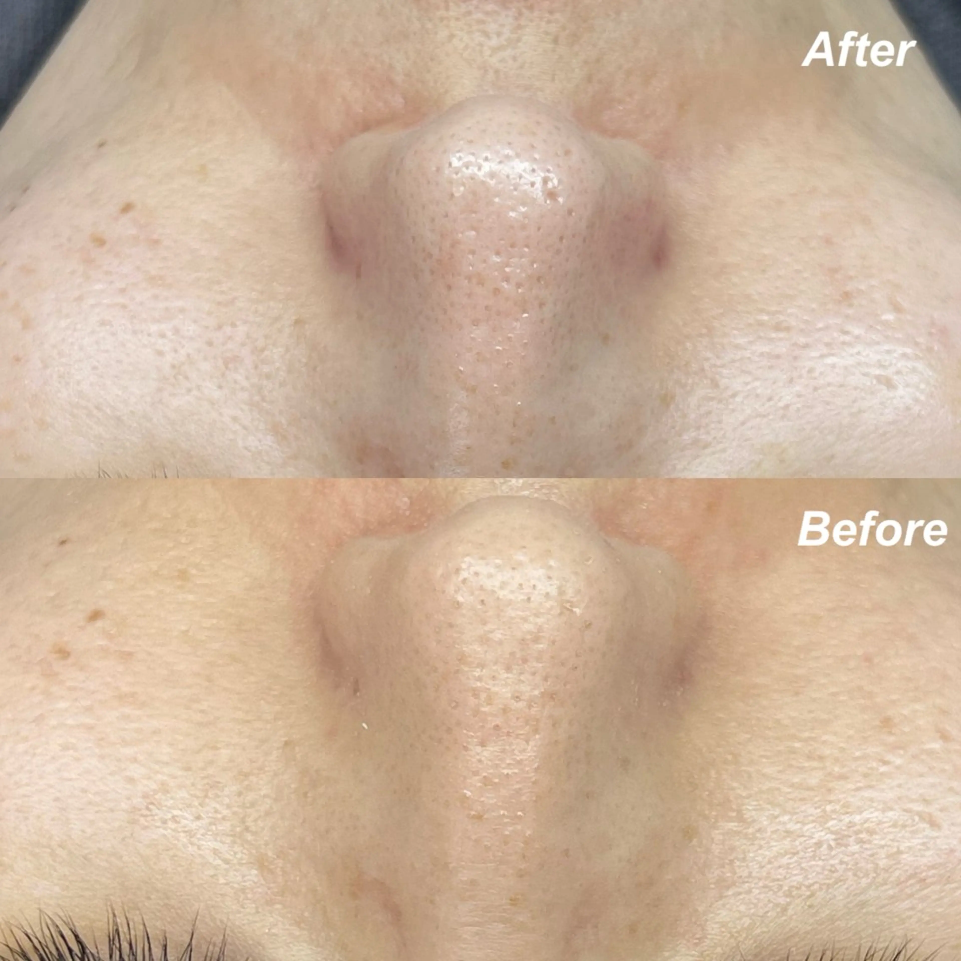 エステ 🌿hitomi🌿 艶肌/肌質改善のエステ・リラクイメージ