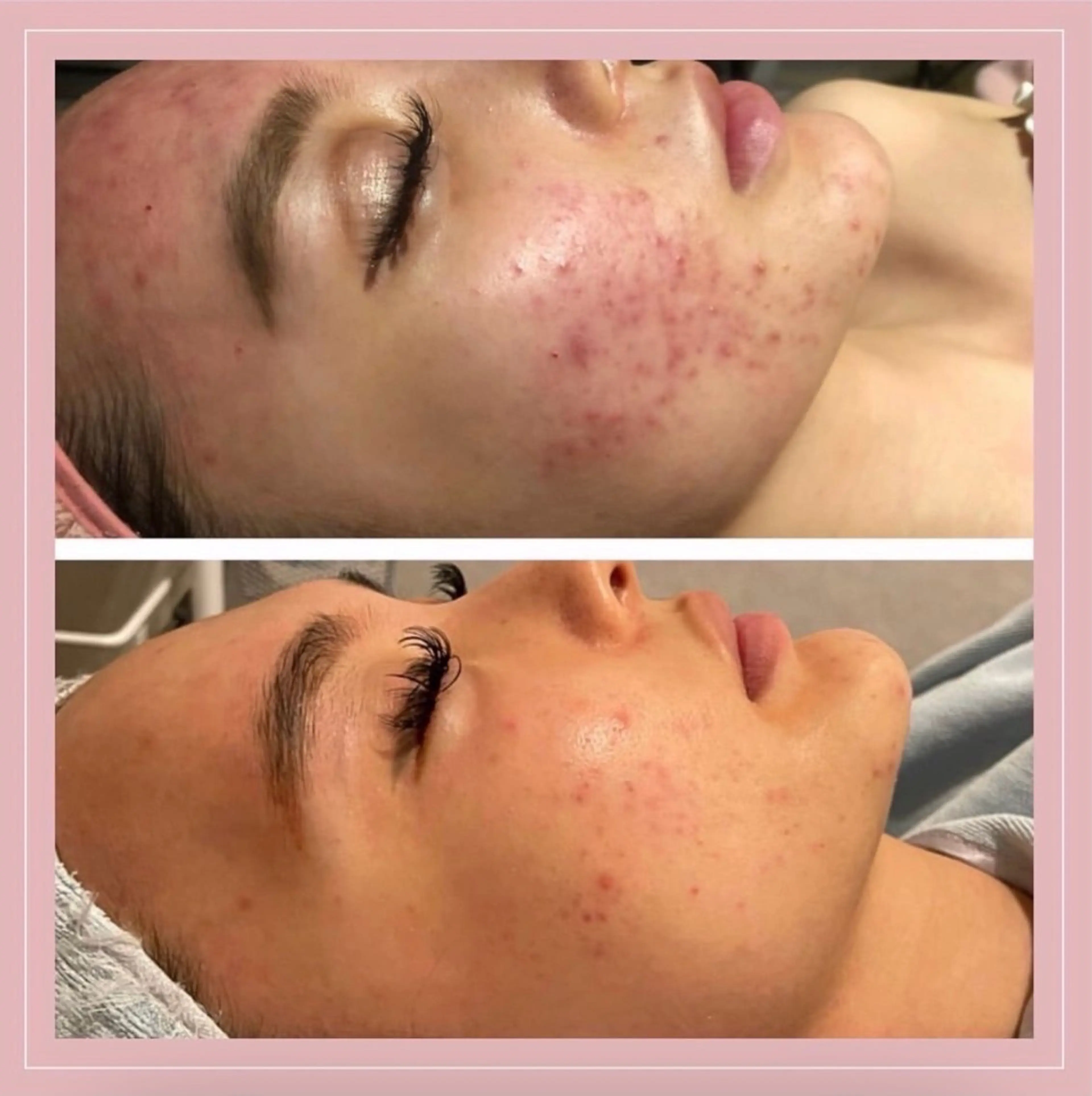 エステ エステティックサロンVive所属・エステティックサロン Viveのエステ・リラクイメージ