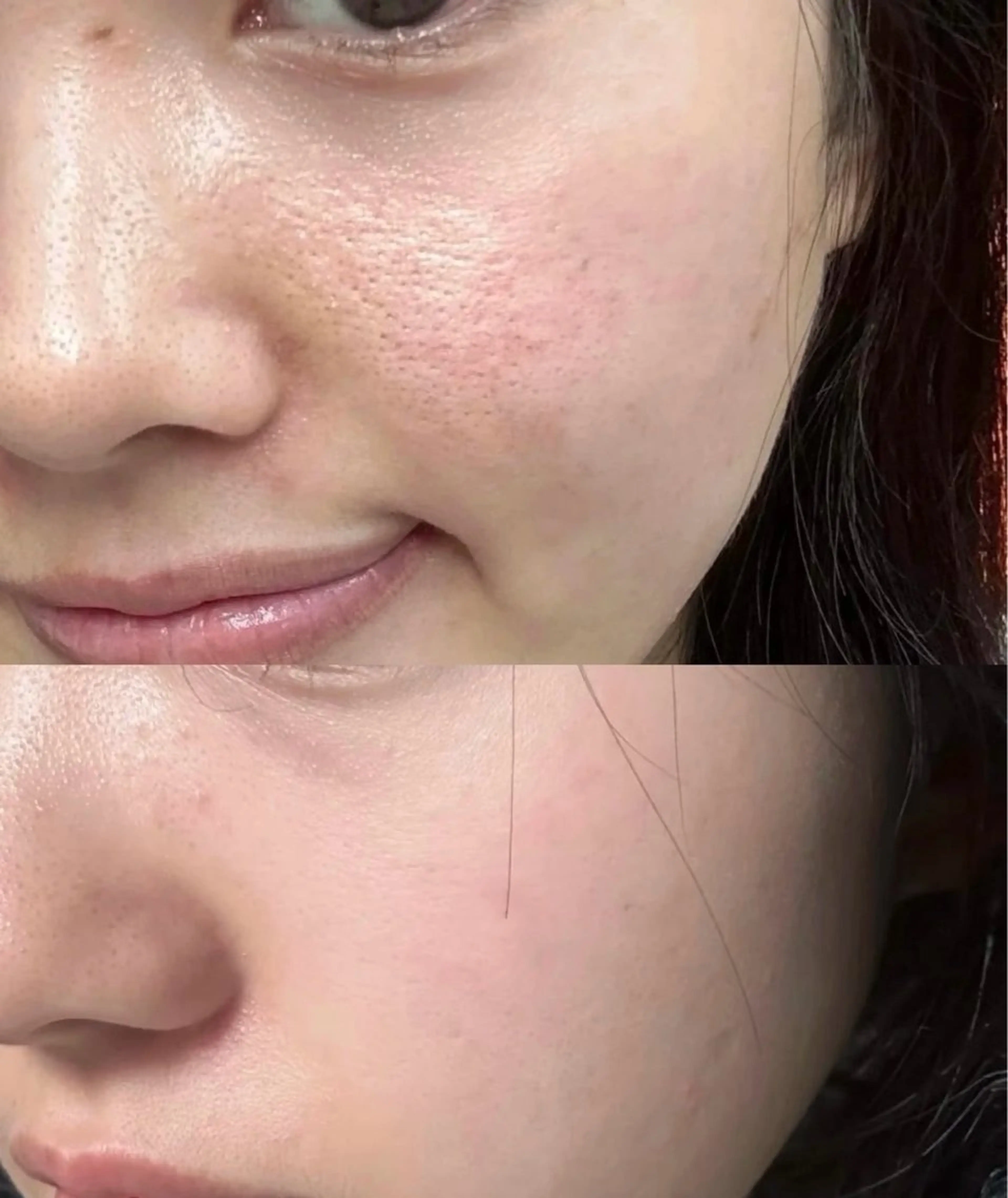 マツエク・マツパ エステ aliaハーブ水光店 エステティシャン募集のエステ・リラクイメージ