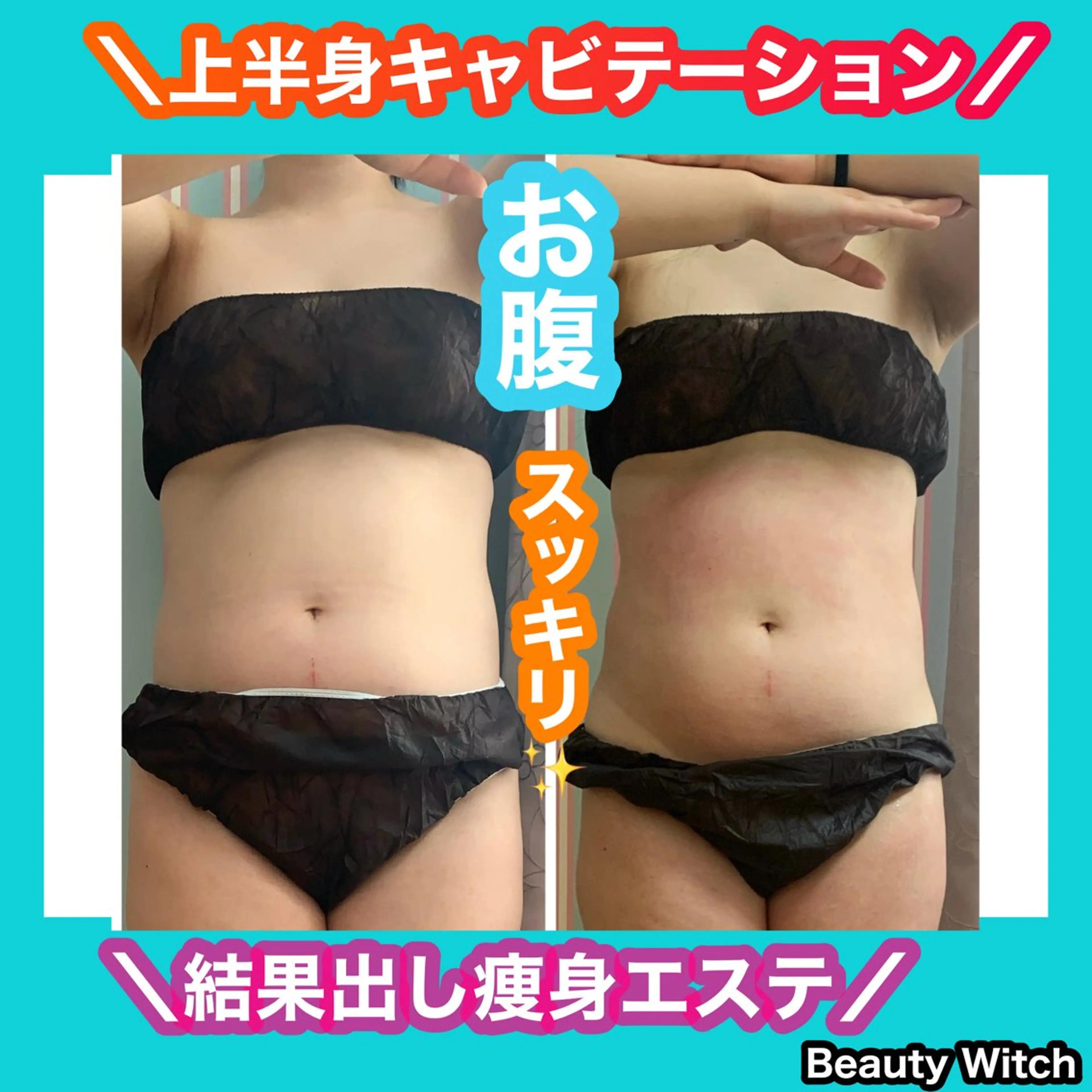 エステ リラク 痩身/脱毛/ネイル HARUKAのエステ・リラクイメージ