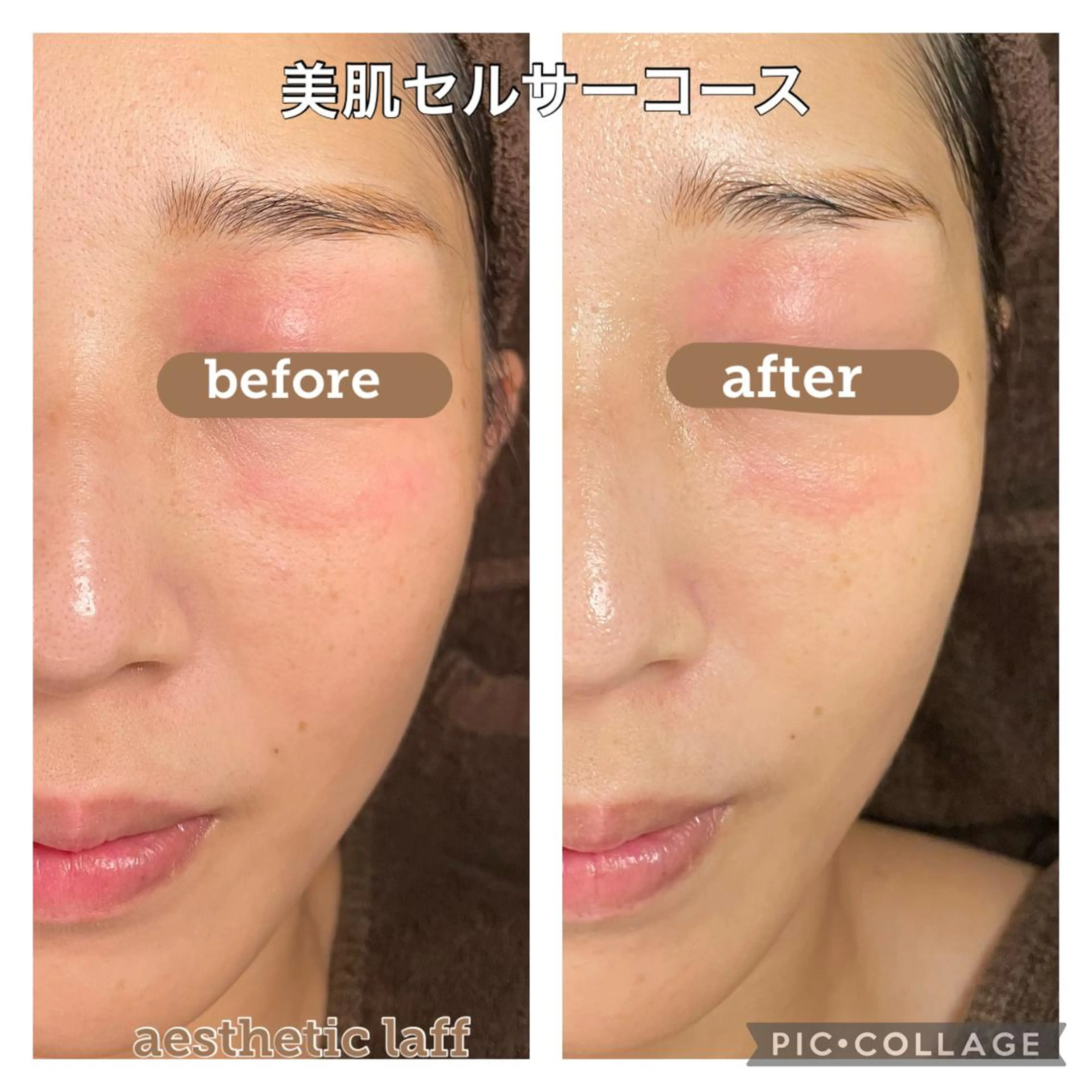 美肌作りのサロン 山村亜美のエステ・リラクイメージ