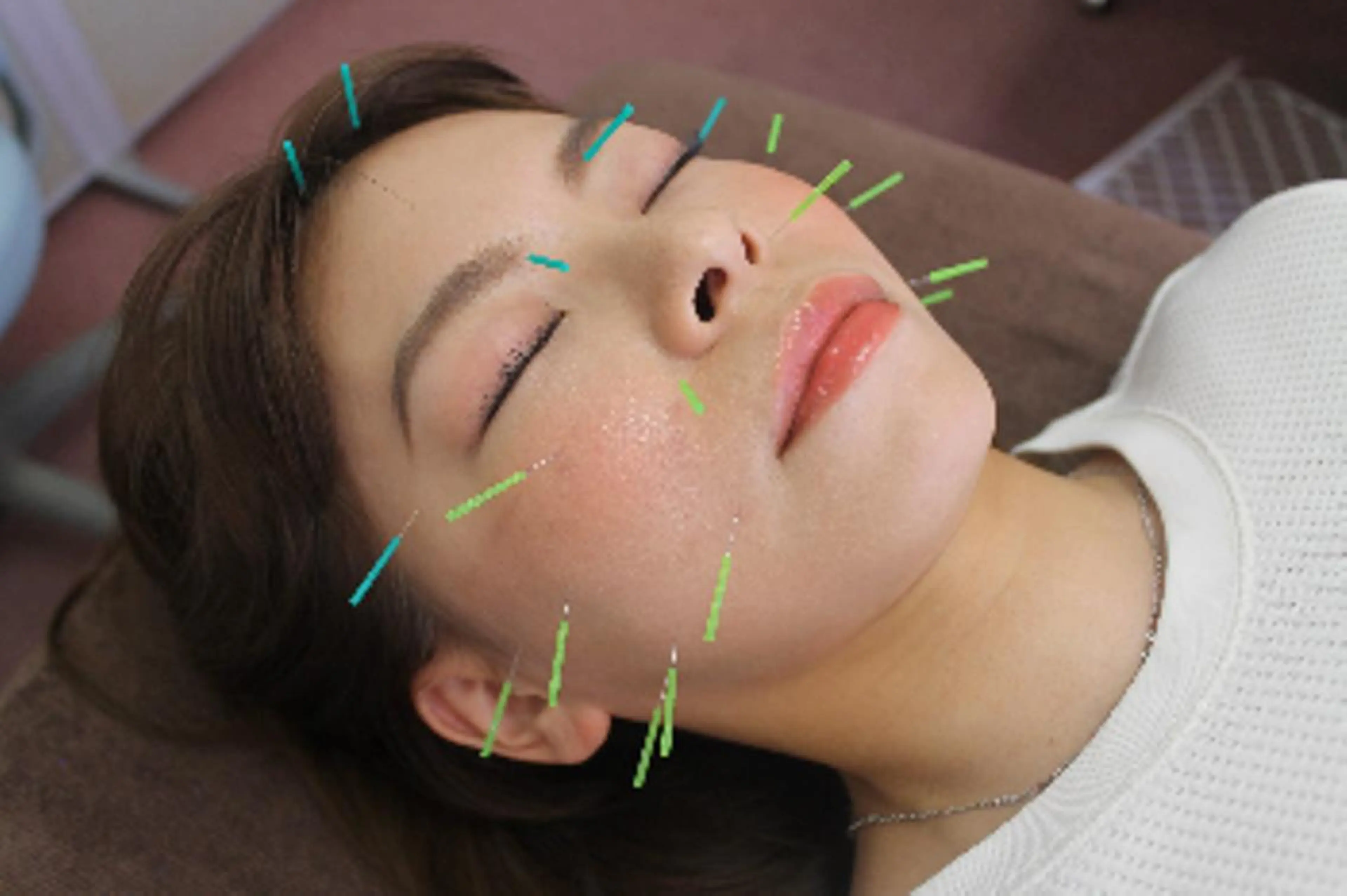 同心整骨院 美容鍼・整体・小顔のエステ・リラクイメージ