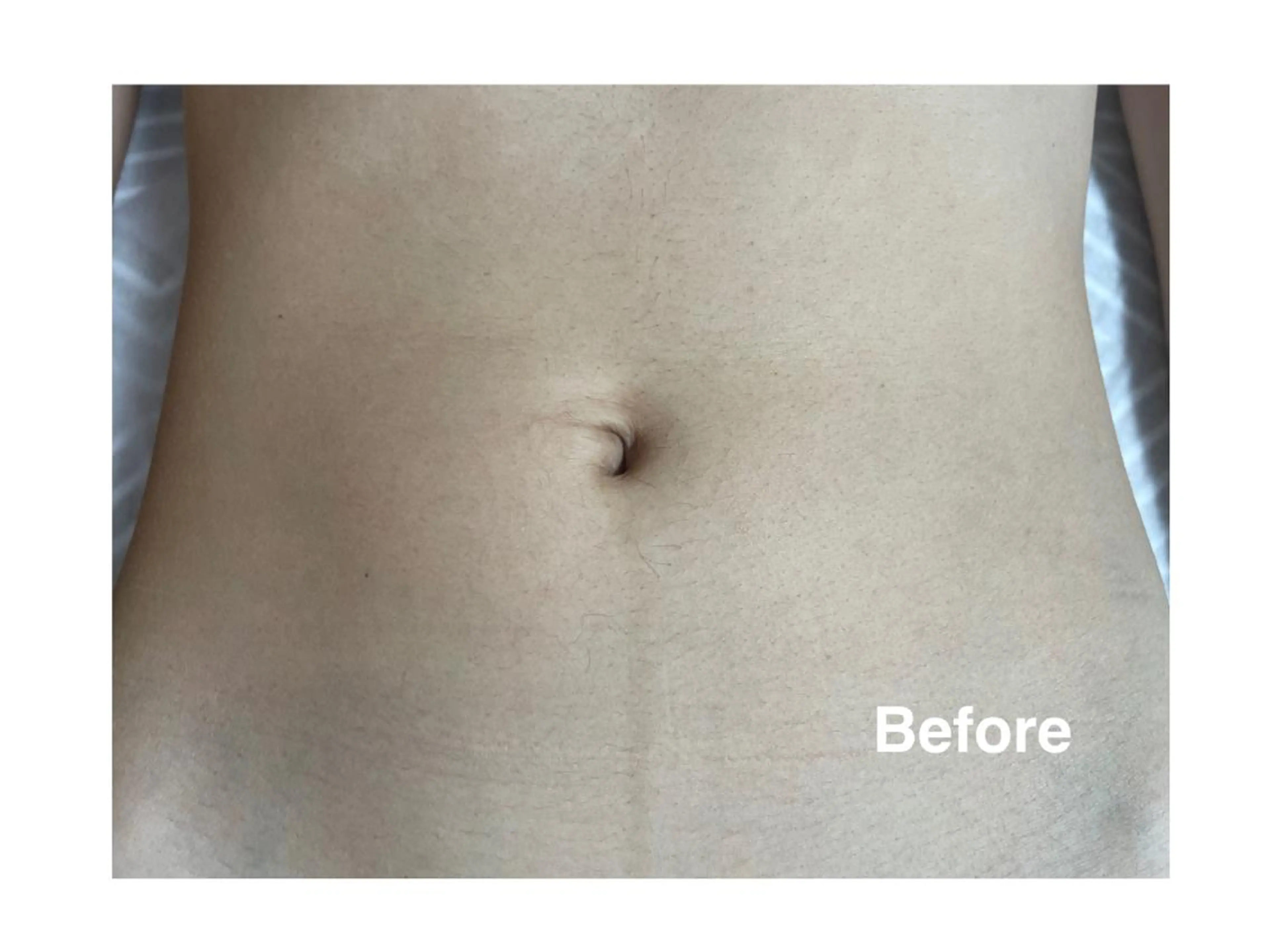 地上のトレチカ sugaringのエステ・リラクイメージ