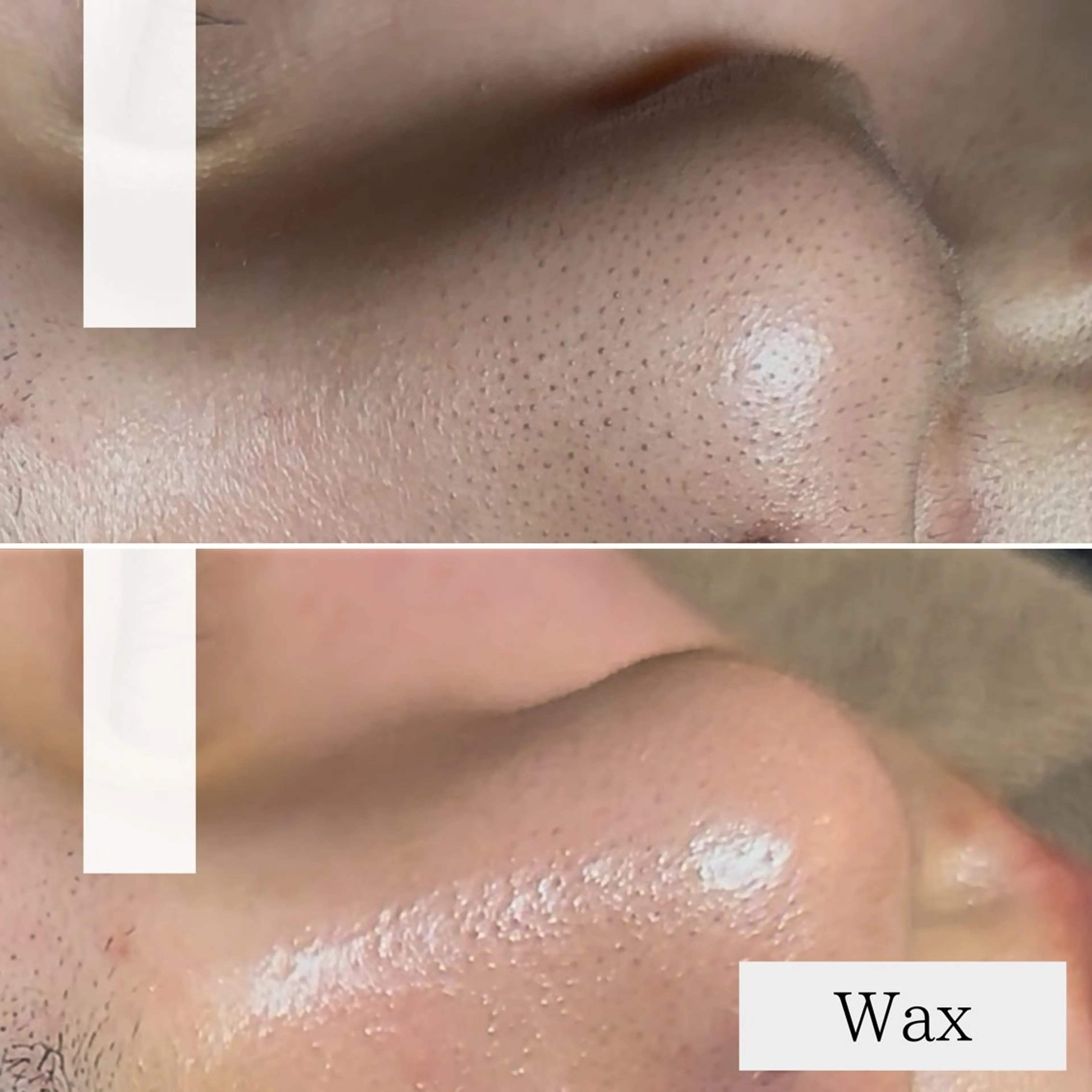 エステ プライベート脱毛サロン　Arum所属・脱毛サロン Arumのエステ・リラクイメージ