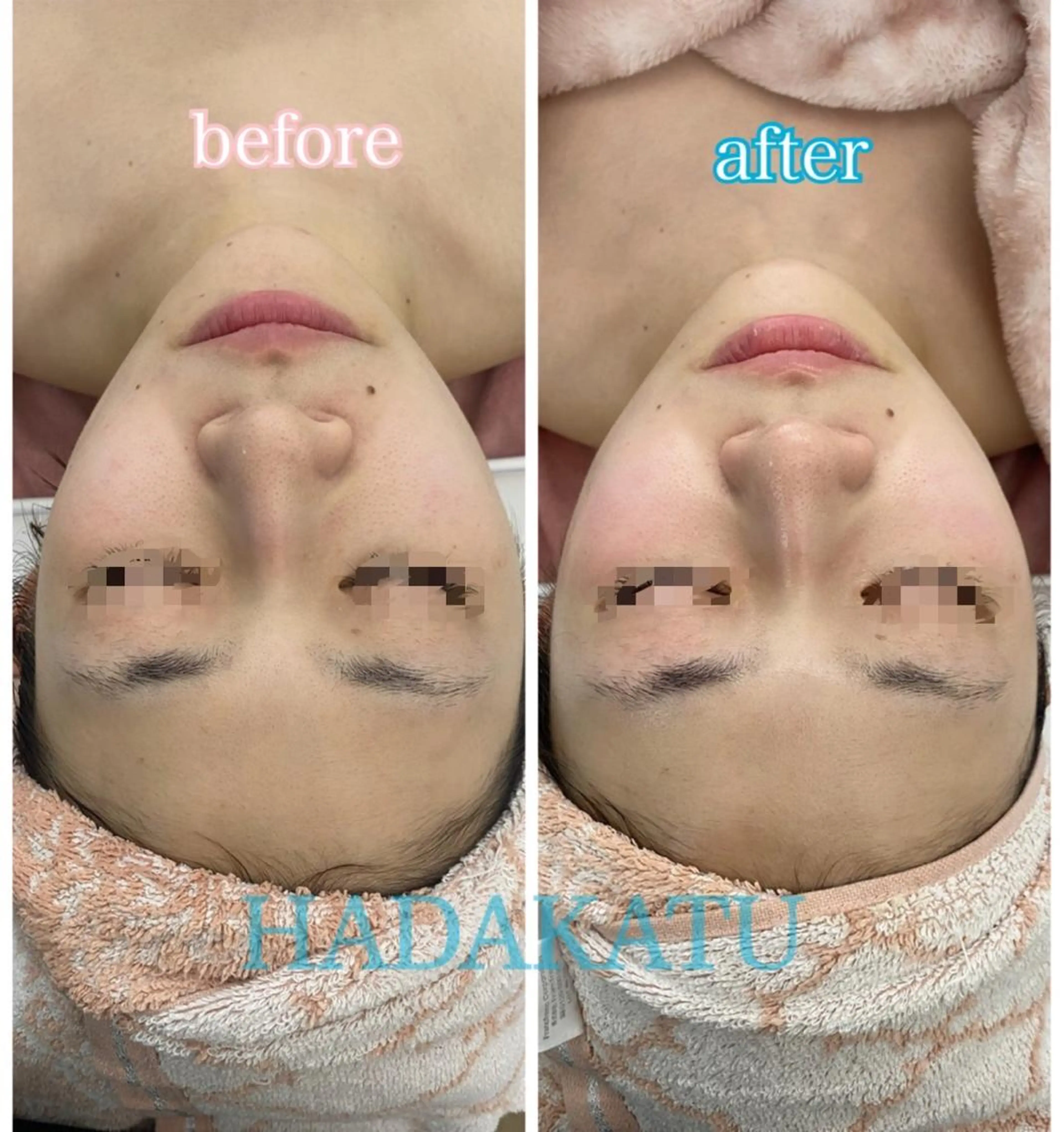 総合エステサロン 肌活のエステ・リラクイメージ