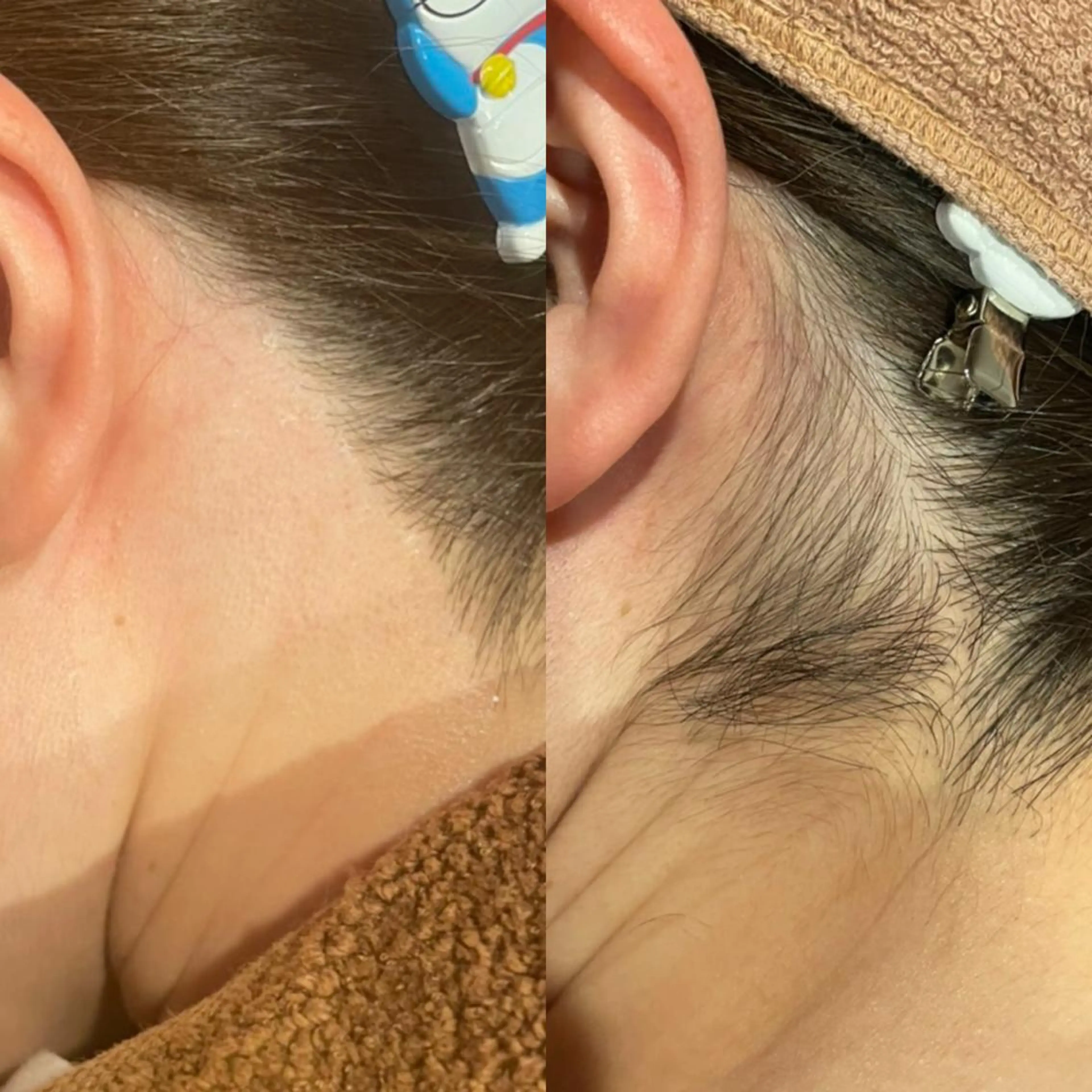 脱毛 GOLDEN AGEのエステ・リラクイメージ