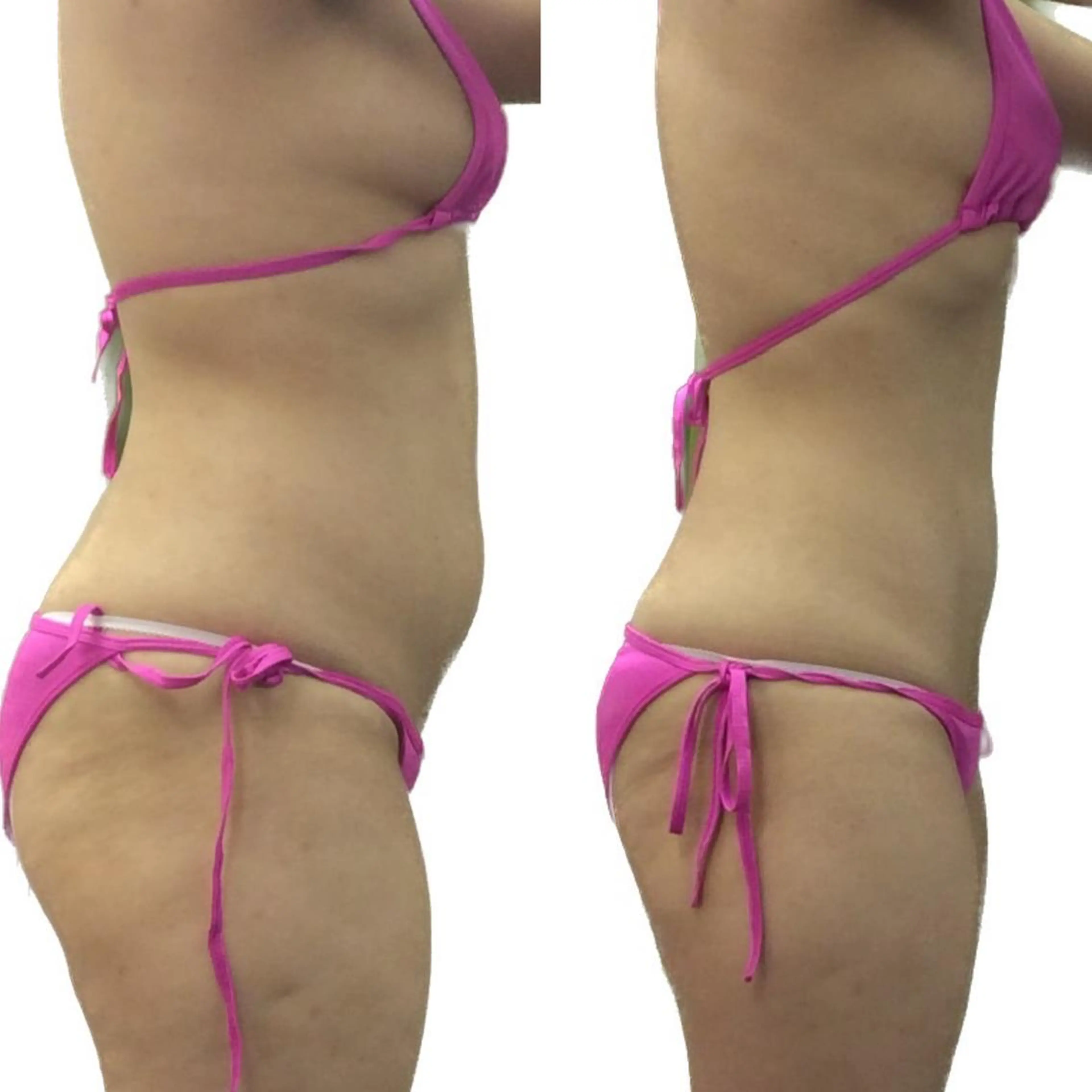 NON-NONプラス 大人の本気痩身のエステ・リラクイメージ