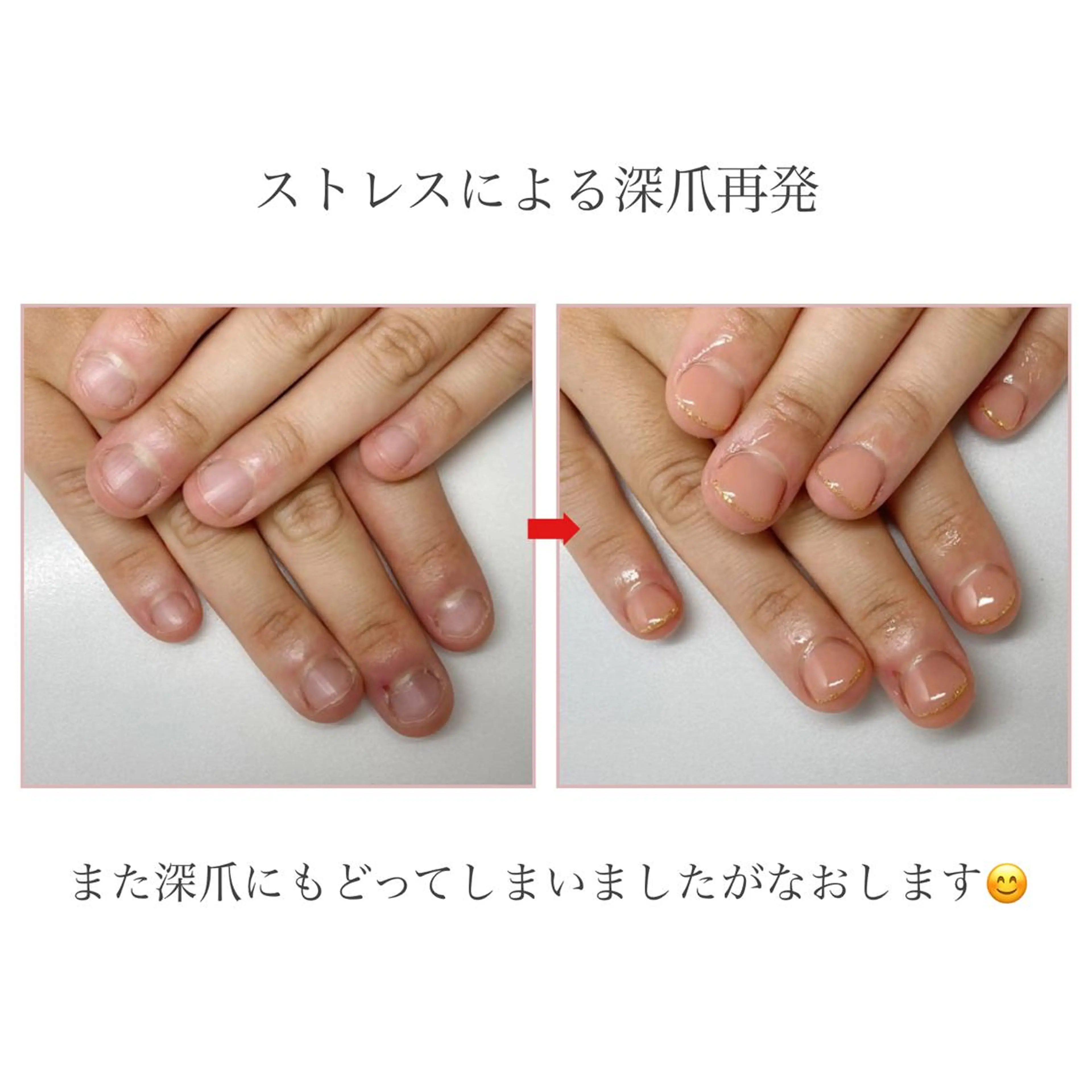 ネイル ネイルサロン アリュームのネイルデザイン